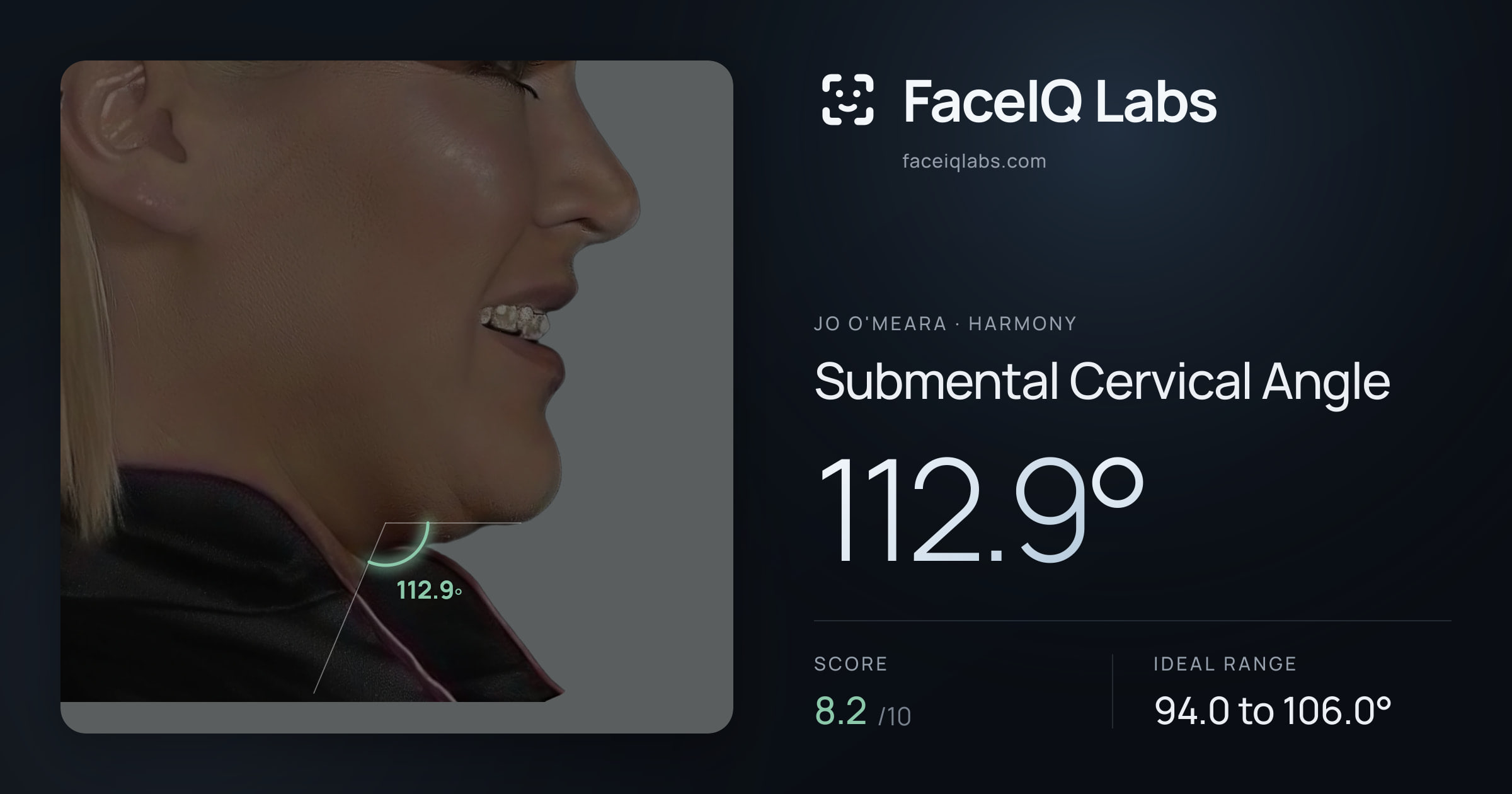 Jo O'Meara Submental Cervical Angle: 112.9°, drawn on the photo