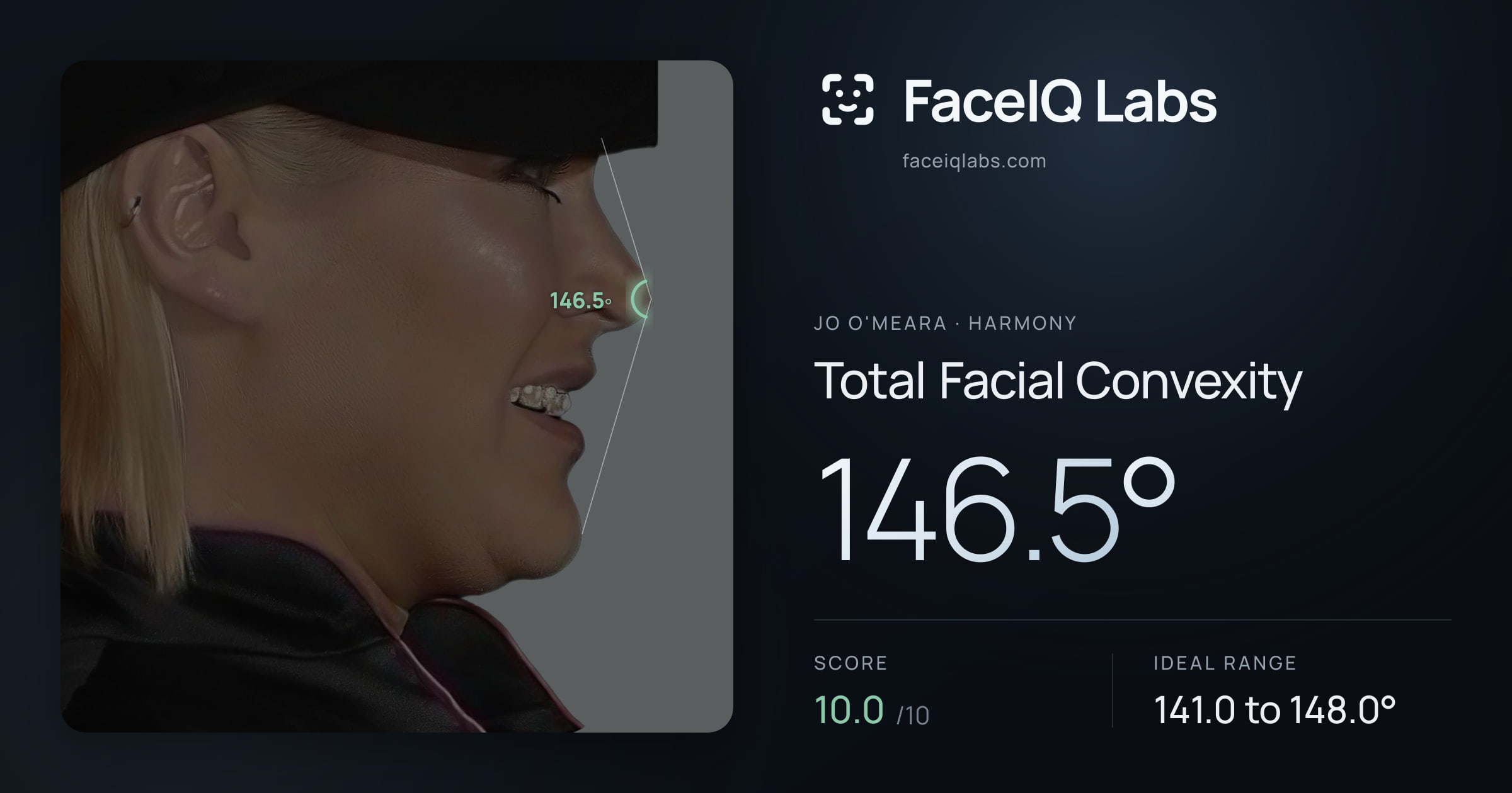 Jo O'Meara Total Facial Convexity: 146.5°, drawn on the photo