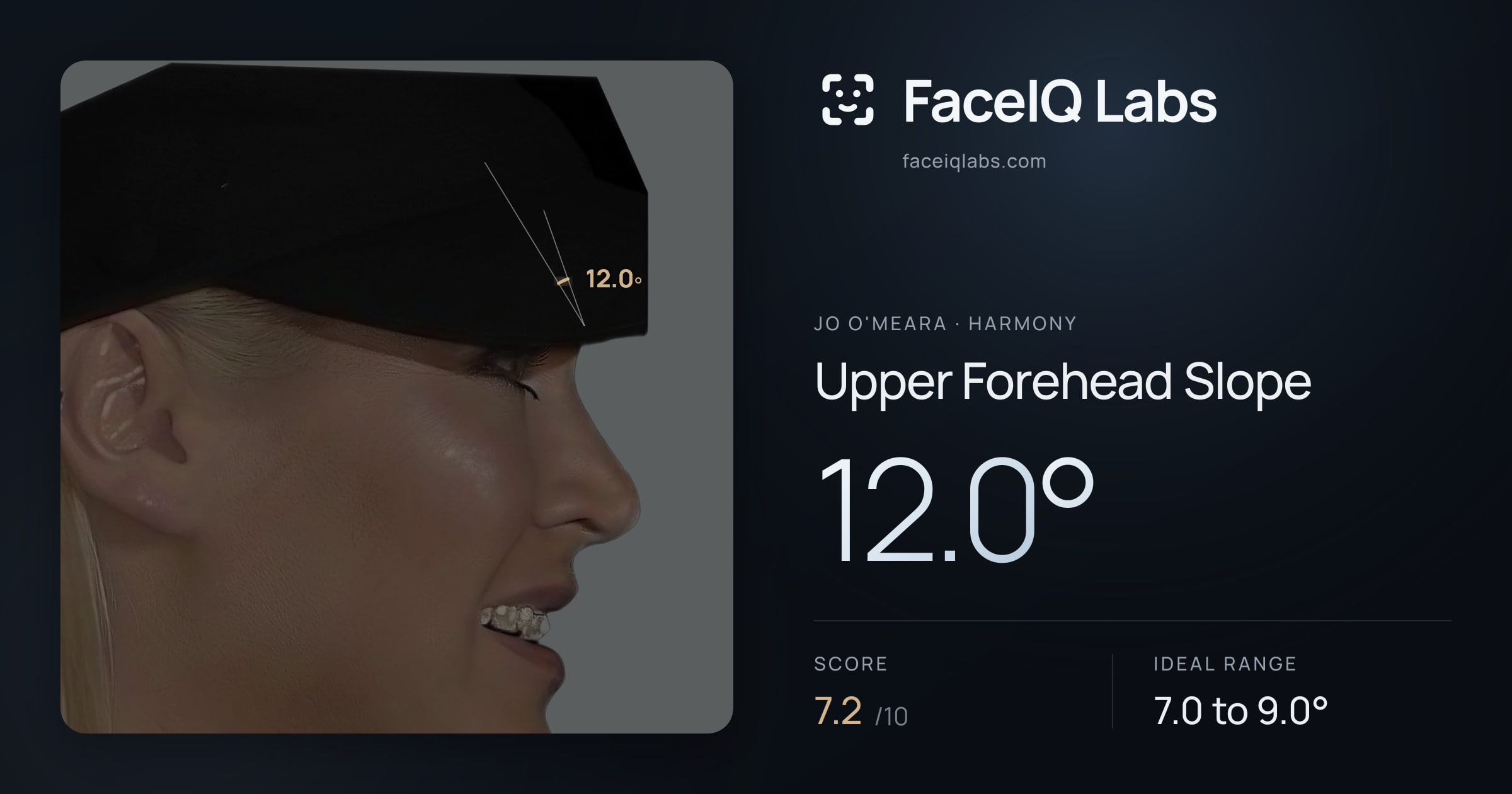 Jo O'Meara Upper Forehead Slope: 12.0°, drawn on the photo