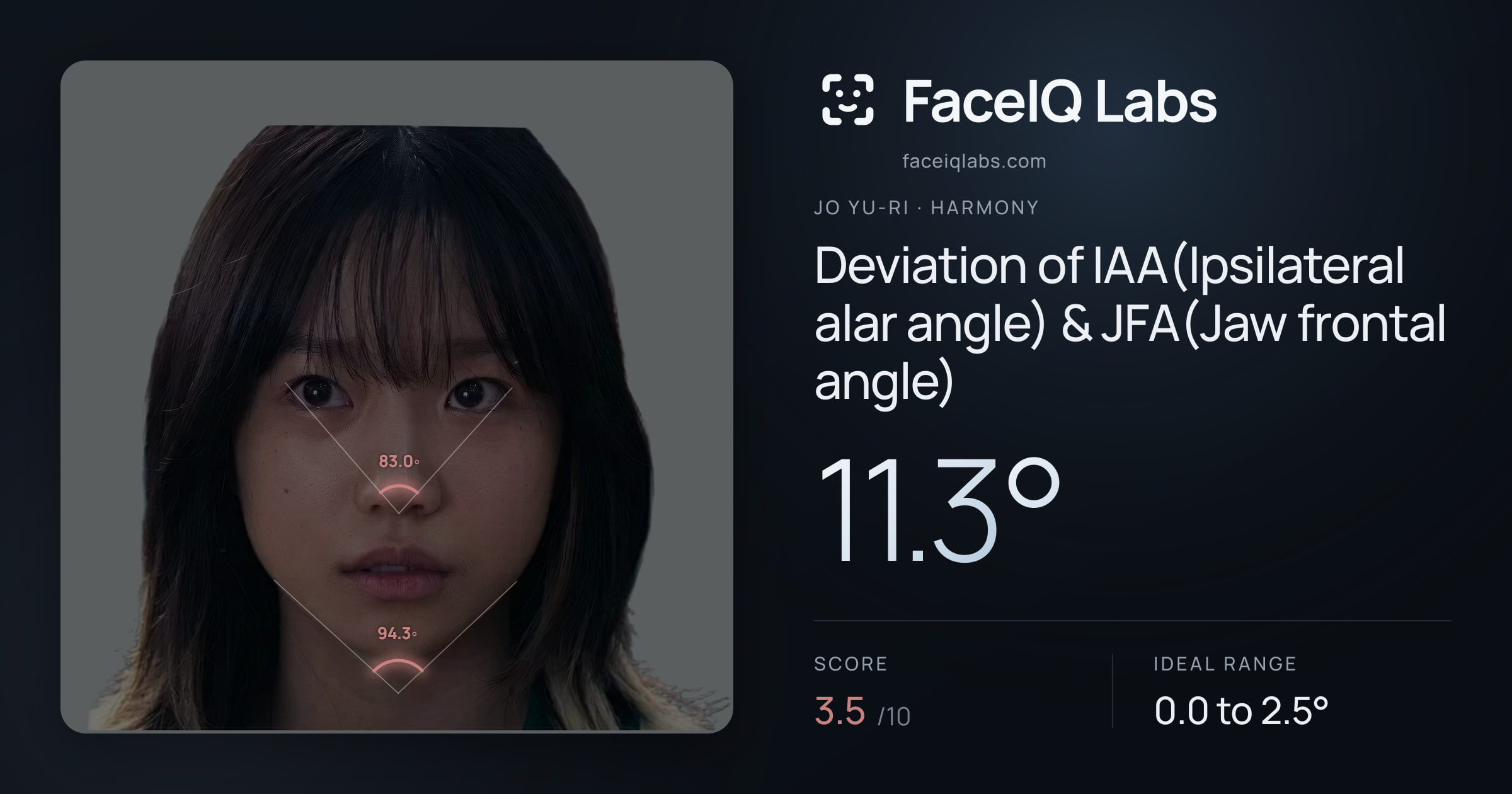Jo Yu-ri Deviation of IAA(Ipsilateral alar angle) & JFA(Jaw frontal angle): 11.3°, drawn on the photo
