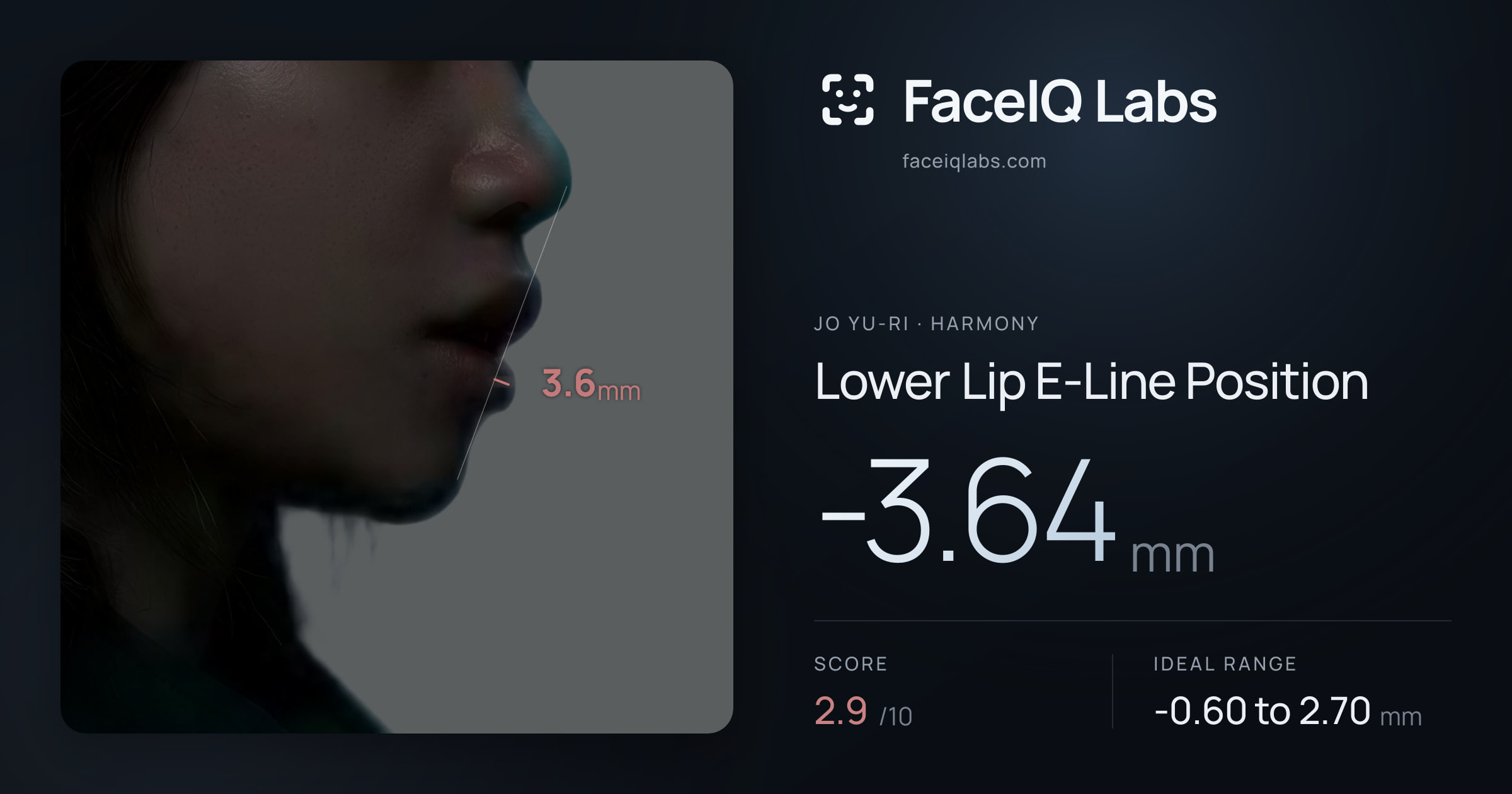 Jo Yu-ri Lower Lip E-Line Position: -3.64mm, drawn on the photo