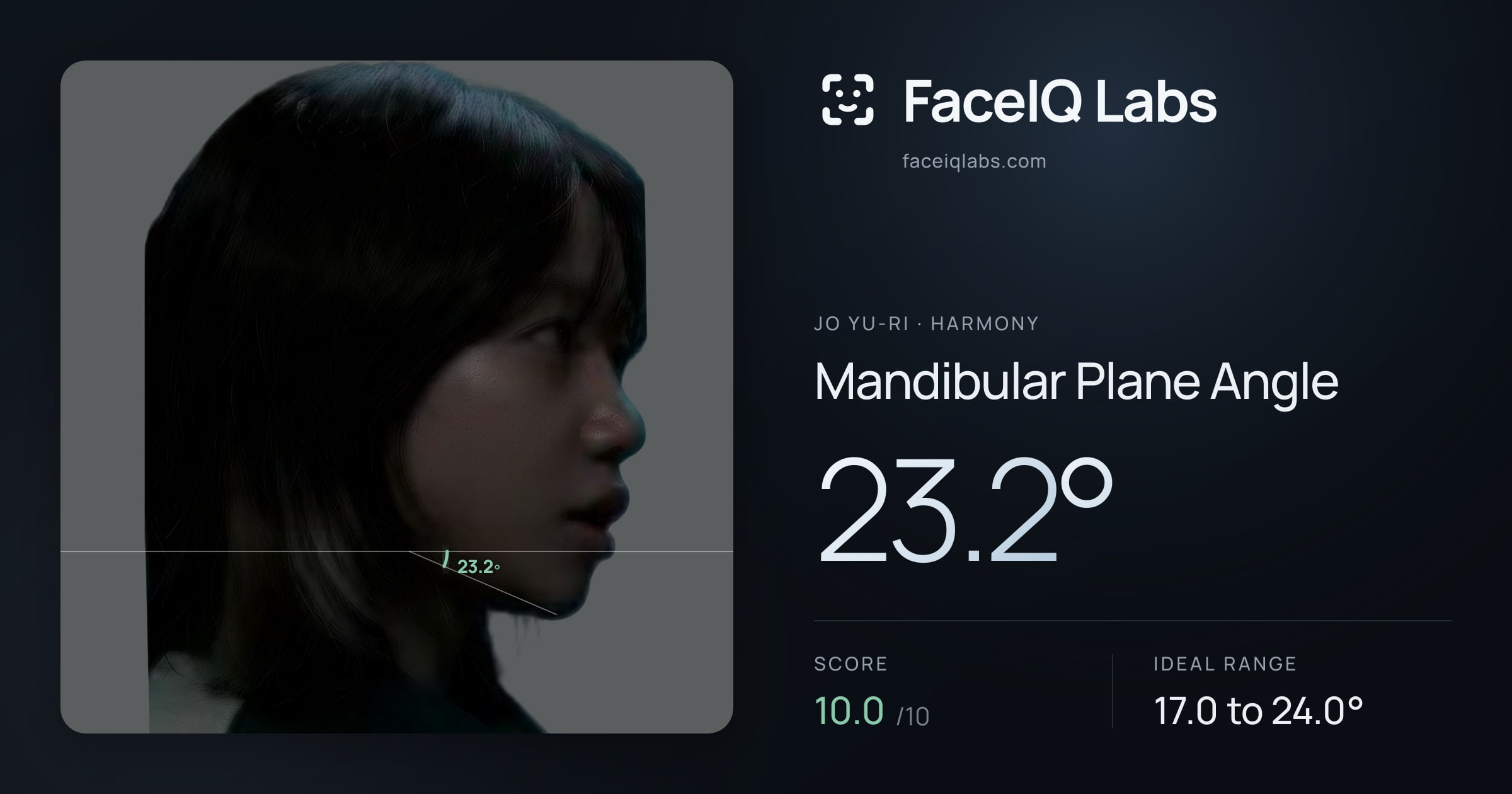 Jo Yu-ri Mandibular Plane Angle: 23.2°, drawn on the photo