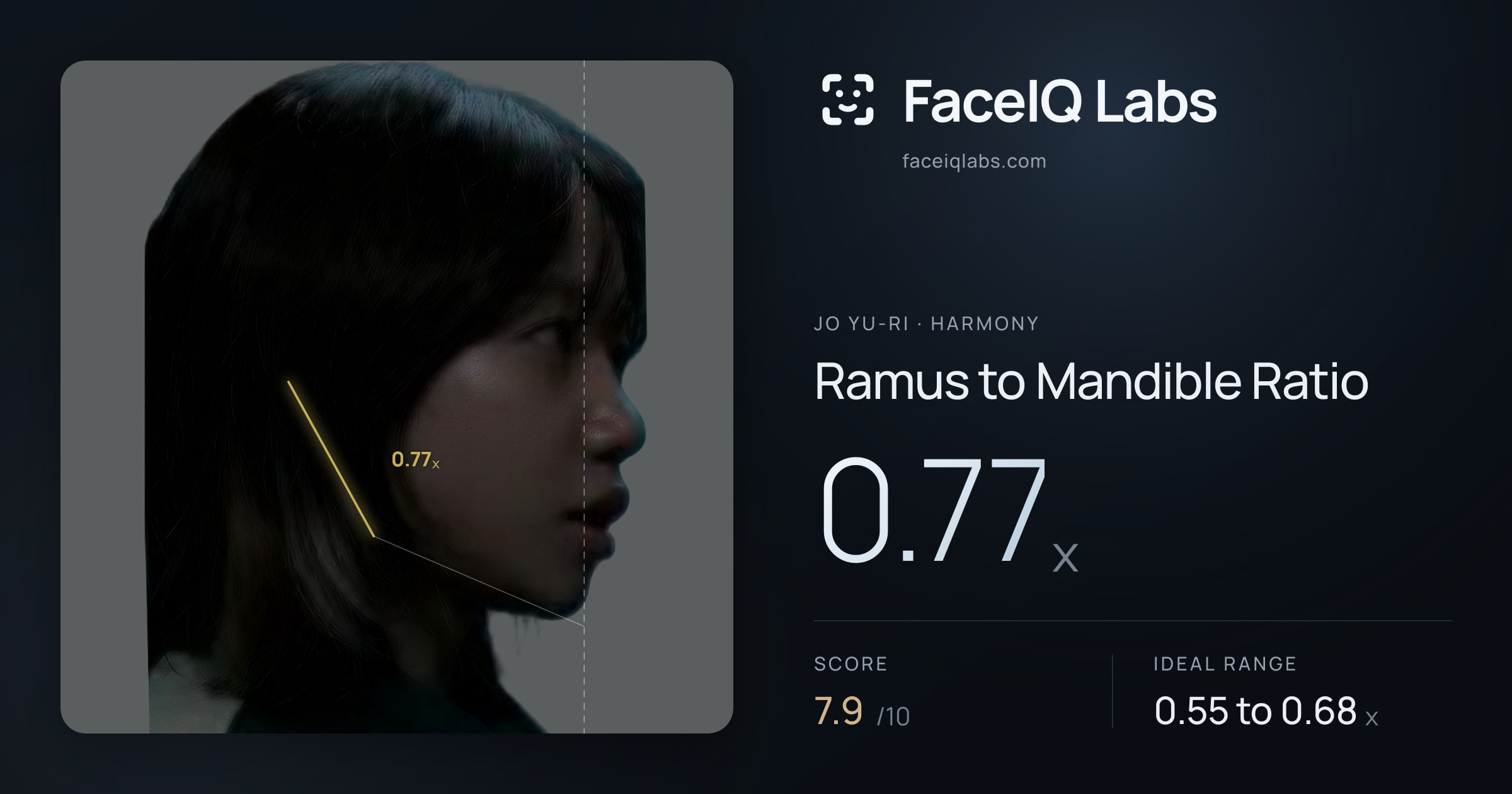 Jo Yu-ri Ramus to Mandible Ratio: 0.77x, drawn on the photo