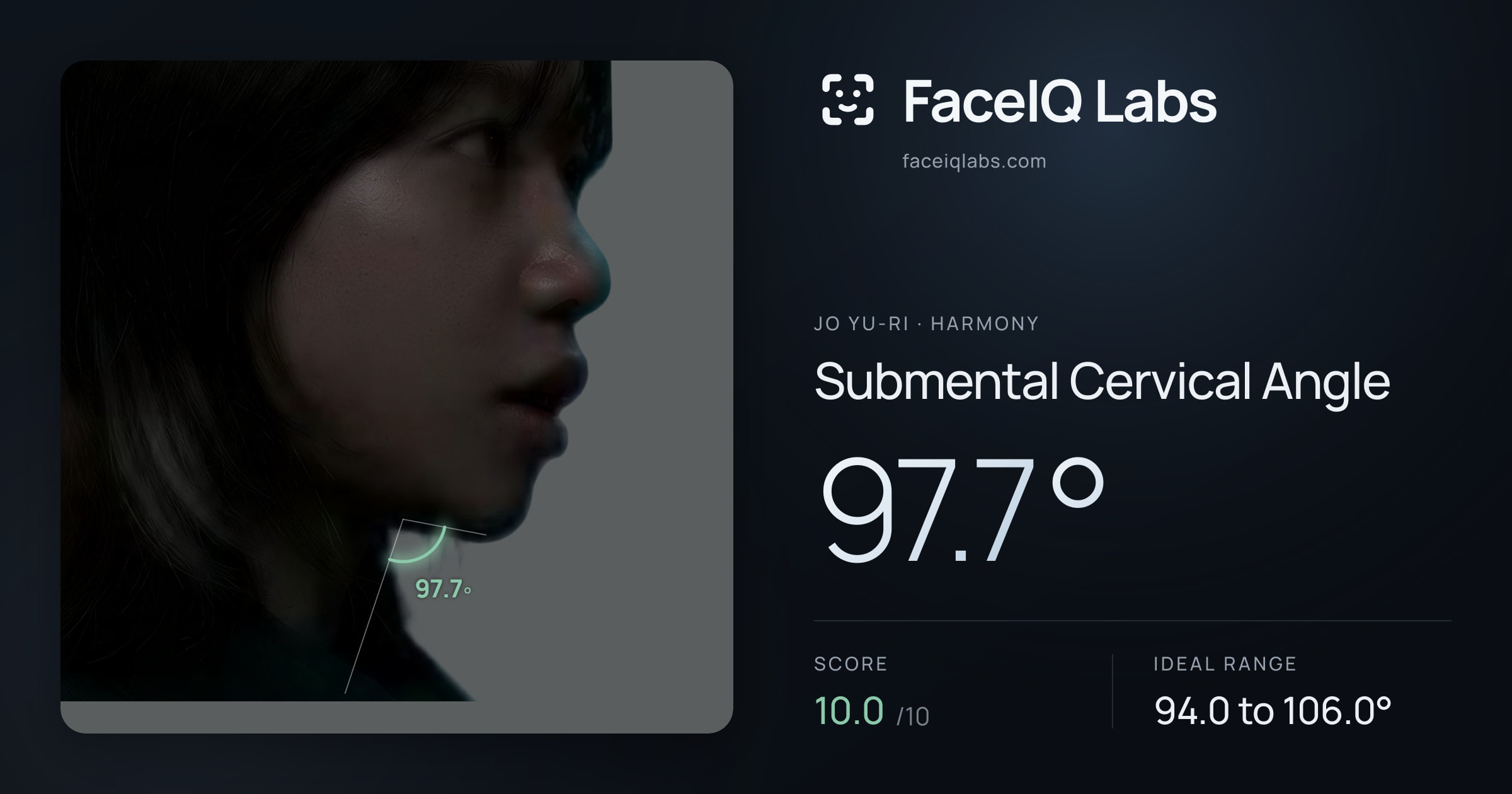 Jo Yu-ri Submental Cervical Angle: 97.7°, drawn on the photo