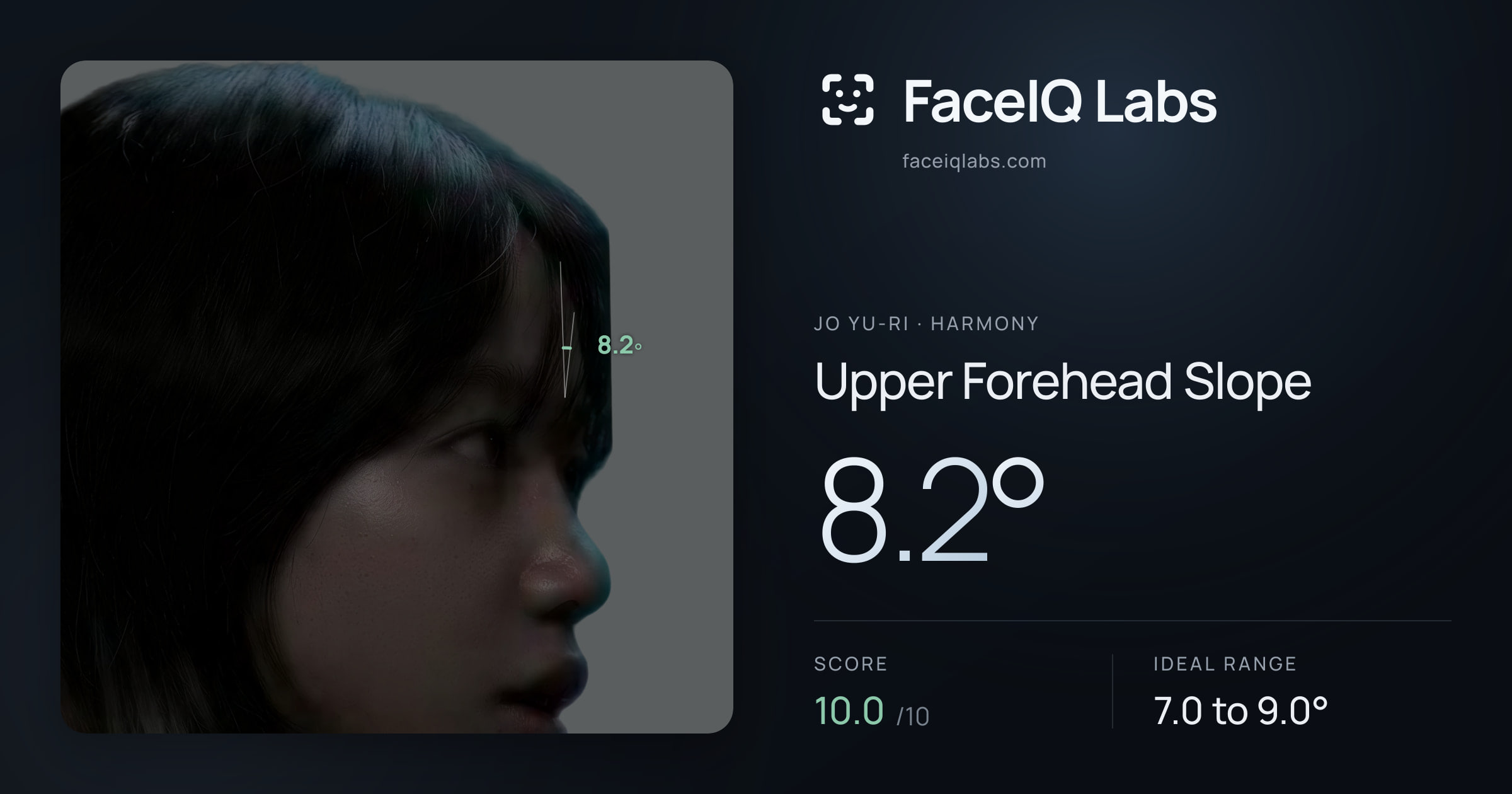 Jo Yu-ri Upper Forehead Slope: 8.2°, drawn on the photo
