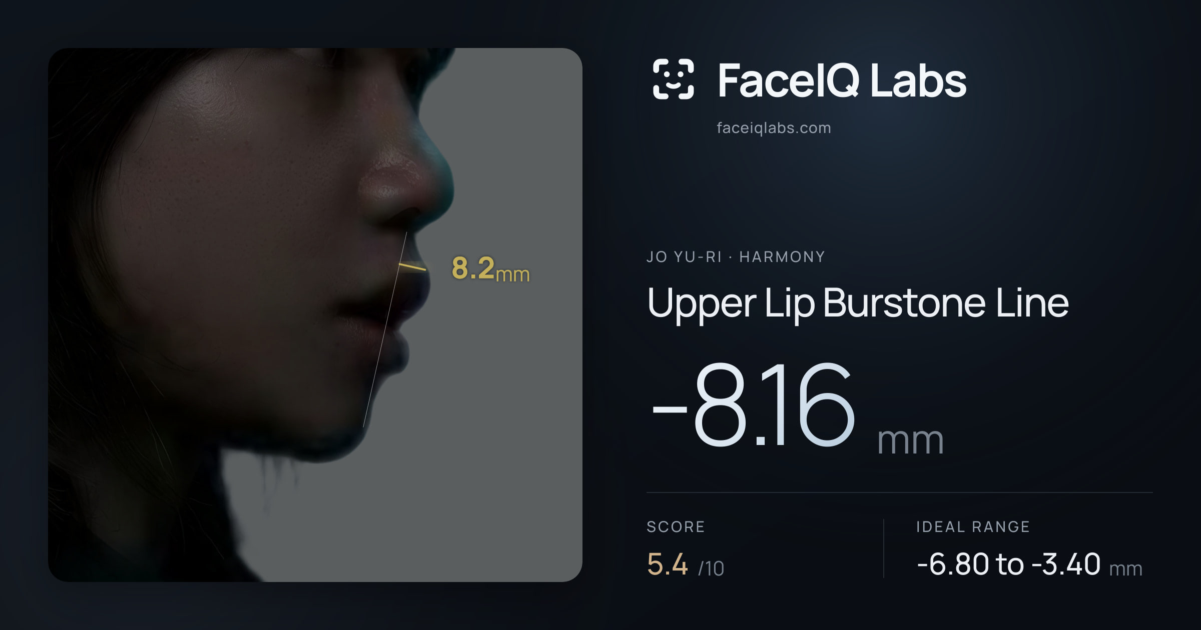 Jo Yu-ri Upper Lip Burstone Line: -8.16mm, drawn on the photo