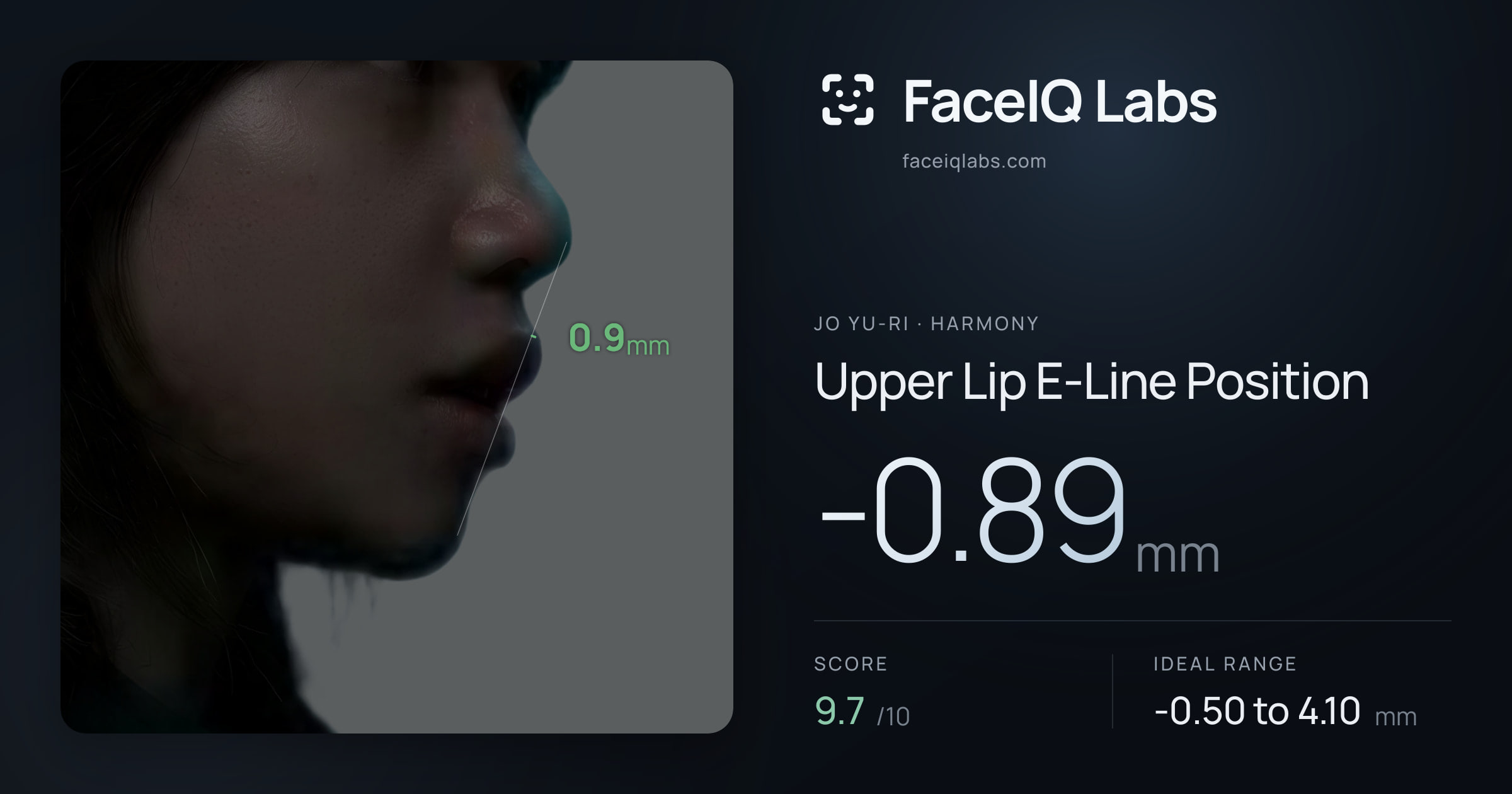 Jo Yu-ri Upper Lip E-Line Position: -0.89mm, drawn on the photo