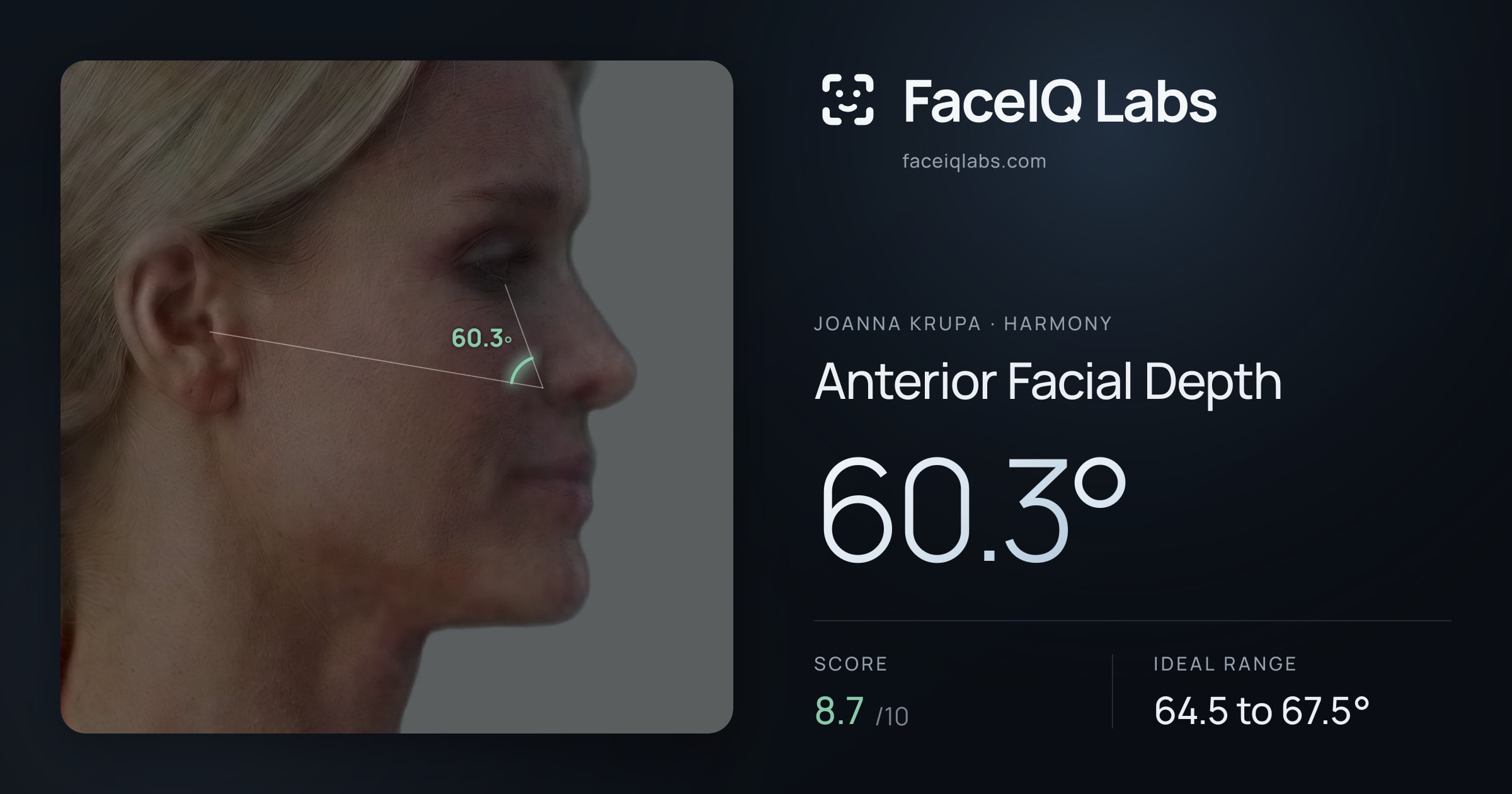 Joanna Krupa Anterior Facial Depth: 60.3°, drawn on the photo