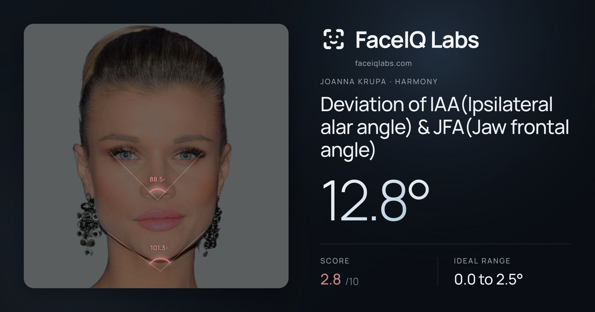 Joanna Krupa Deviation of IAA(Ipsilateral alar angle) & JFA(Jaw frontal angle): 12.8°, drawn on the photo