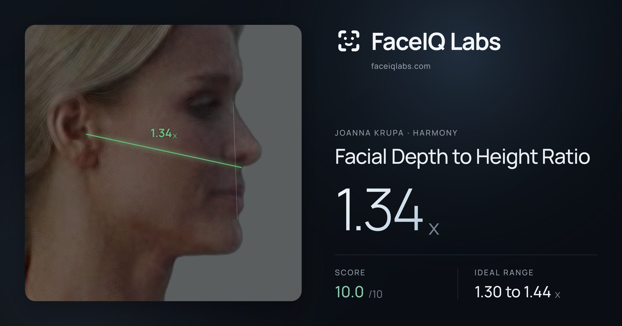 Joanna Krupa Facial Depth to Height Ratio: 1.34x, drawn on the photo