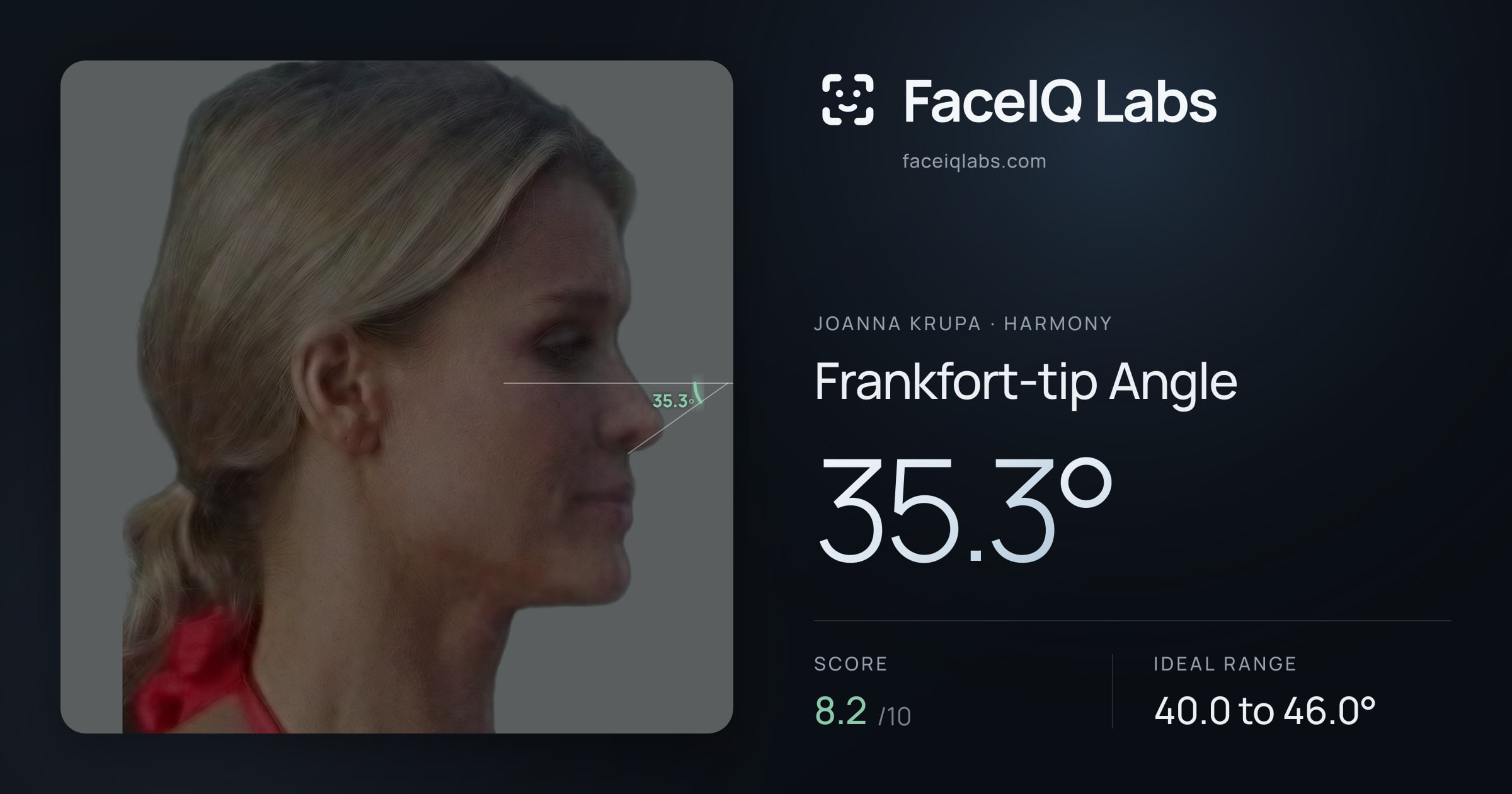 Joanna Krupa Frankfort-tip Angle: 35.3°, drawn on the photo