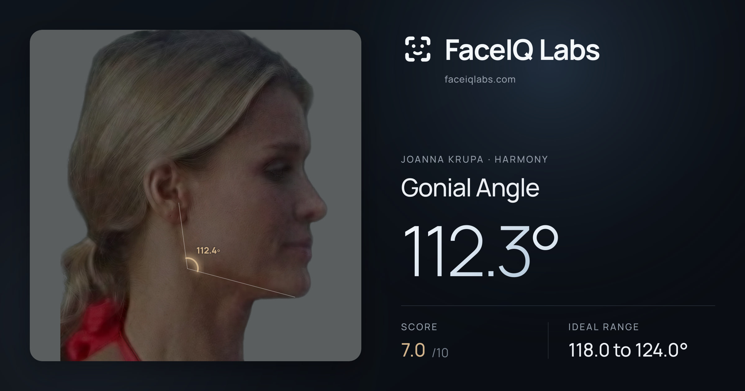 Joanna Krupa Gonial Angle: 112.3°, drawn on the photo