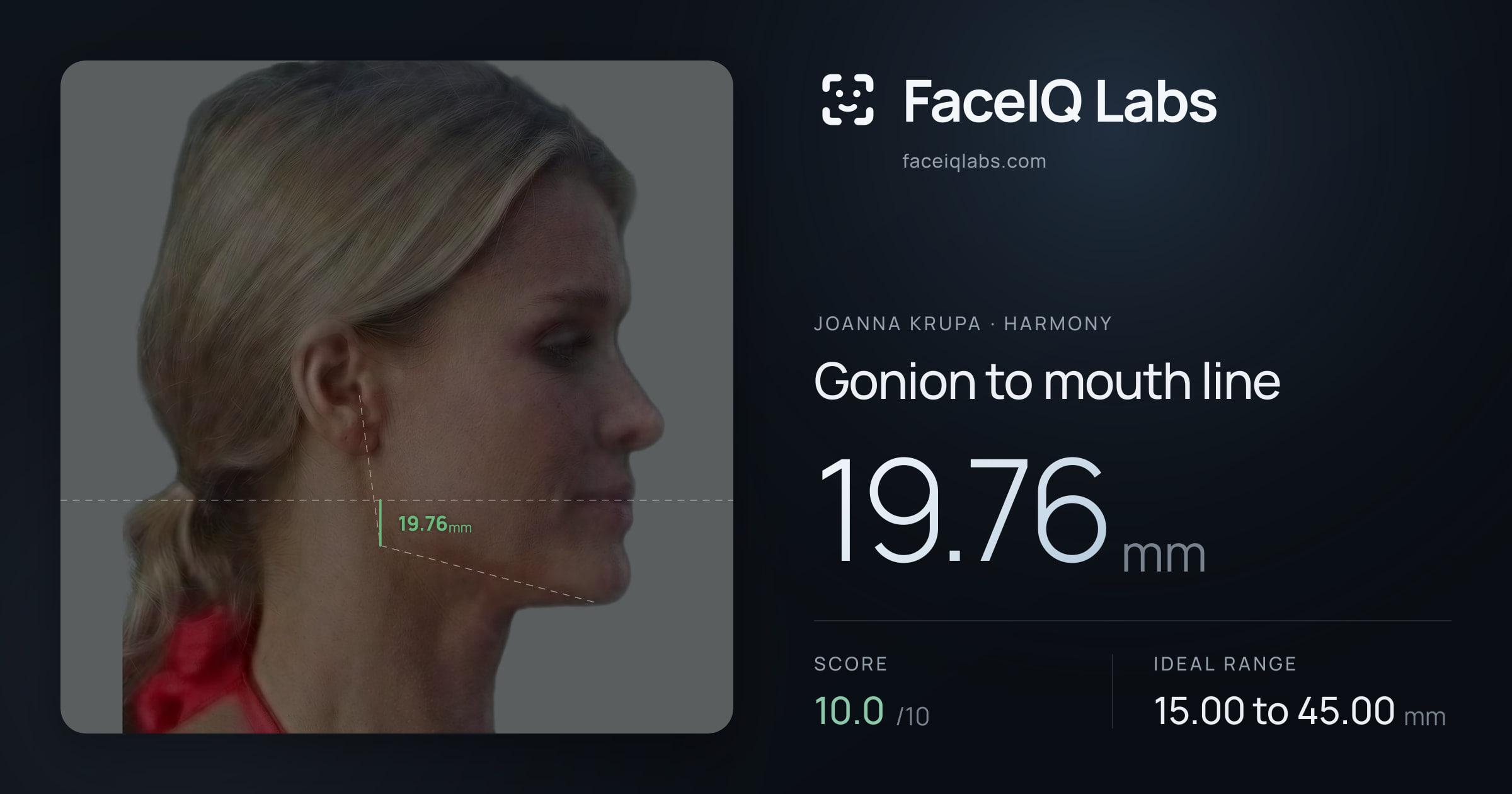 Joanna Krupa Gonion to mouth line: 19.76mm, drawn on the photo