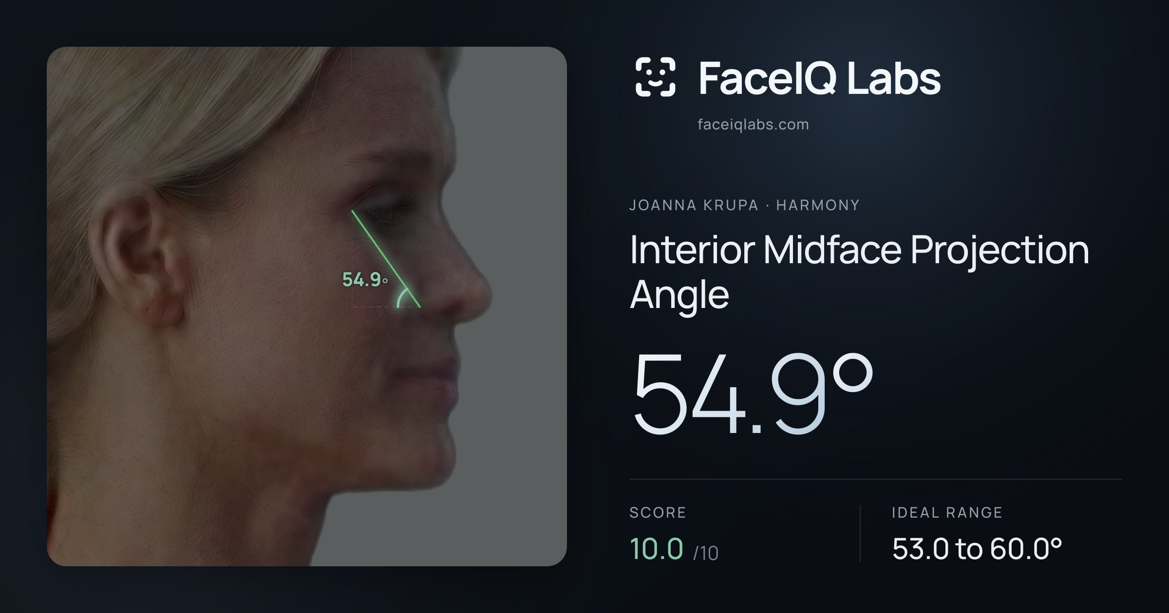 Joanna Krupa Interior Midface Projection Angle: 54.9°, drawn on the photo
