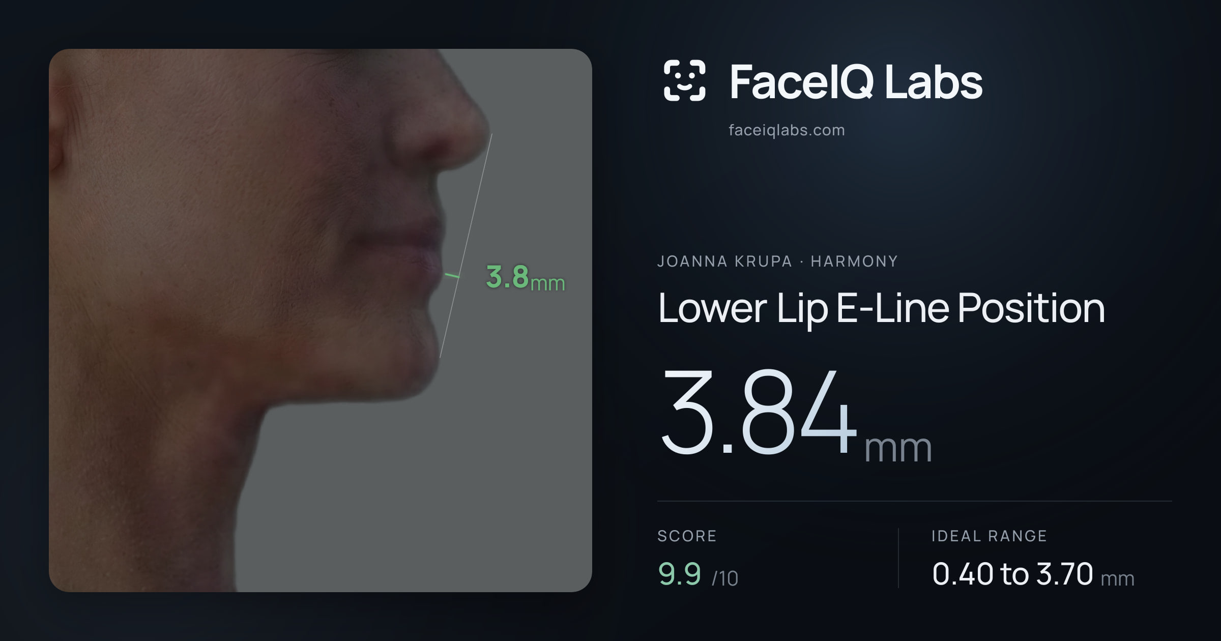 Joanna Krupa Lower Lip E-Line Position: 3.84mm, drawn on the photo