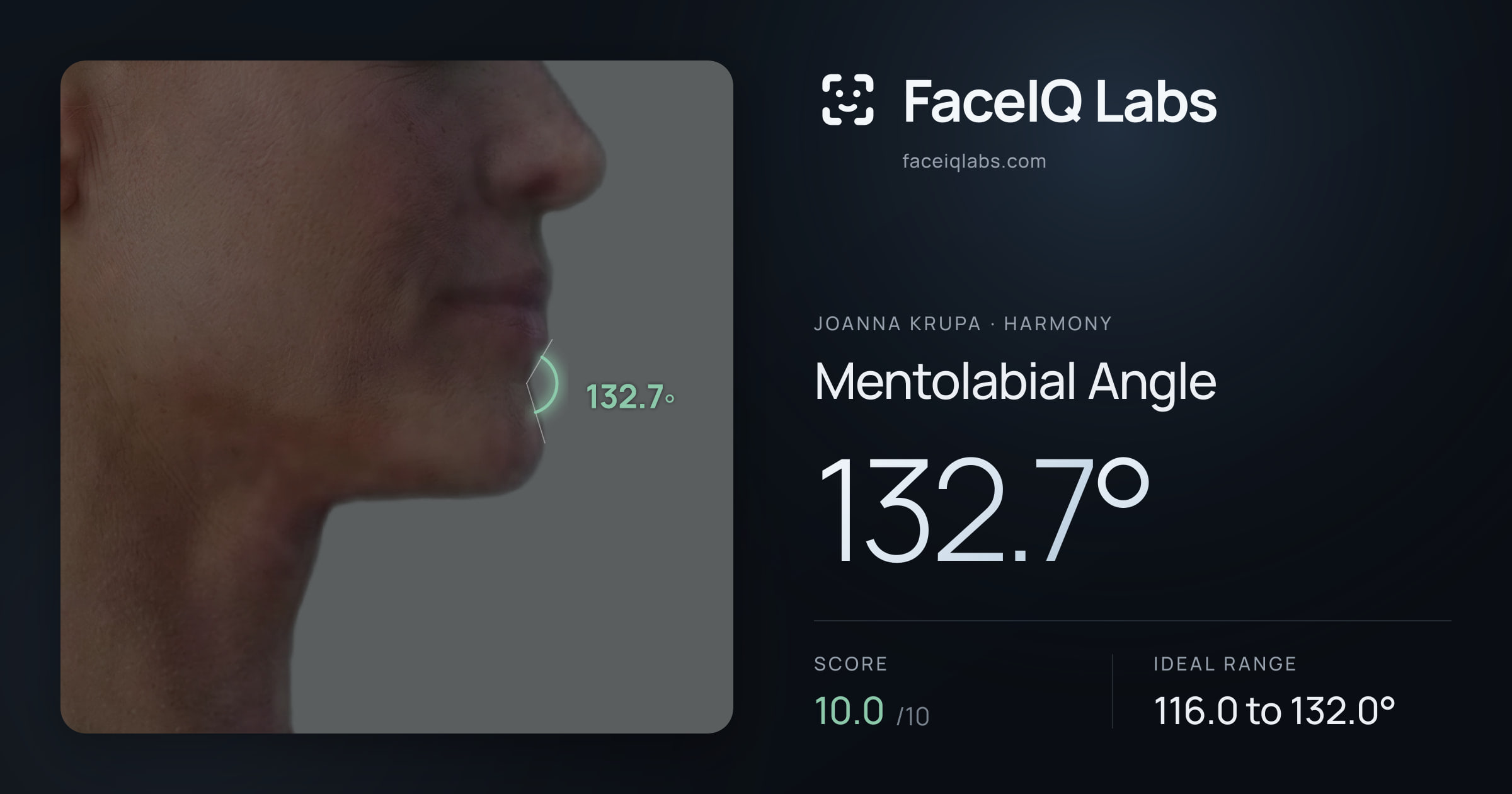 Joanna Krupa Mentolabial Angle: 132.7°, drawn on the photo