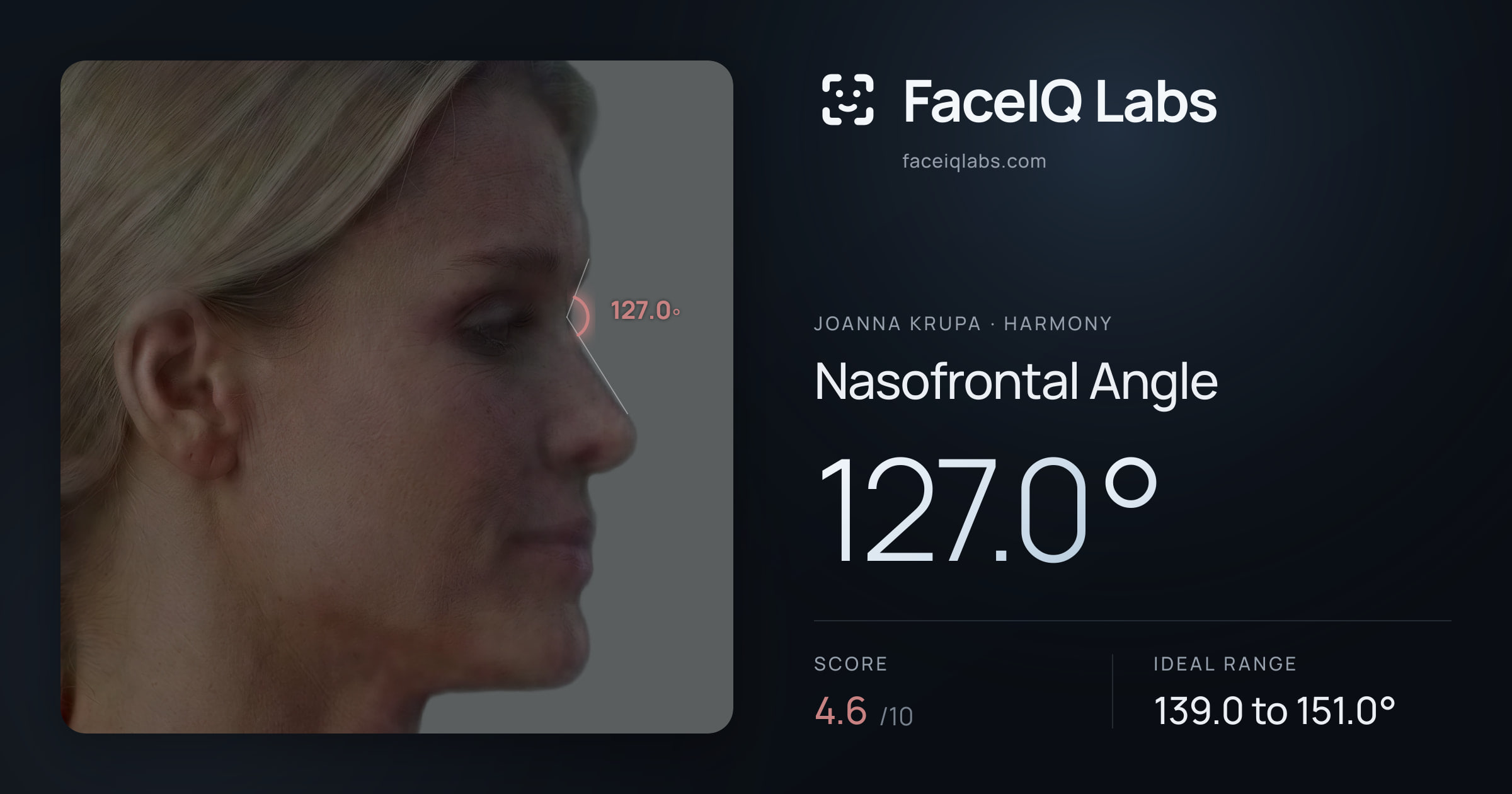 Joanna Krupa Nasofrontal Angle: 127.0°, drawn on the photo