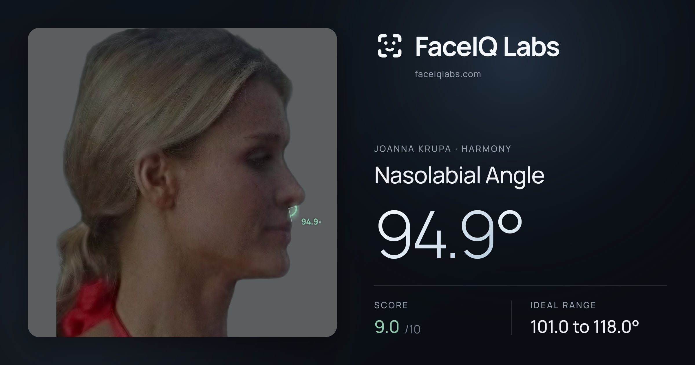 Joanna Krupa Nasolabial Angle: 94.9°, drawn on the photo