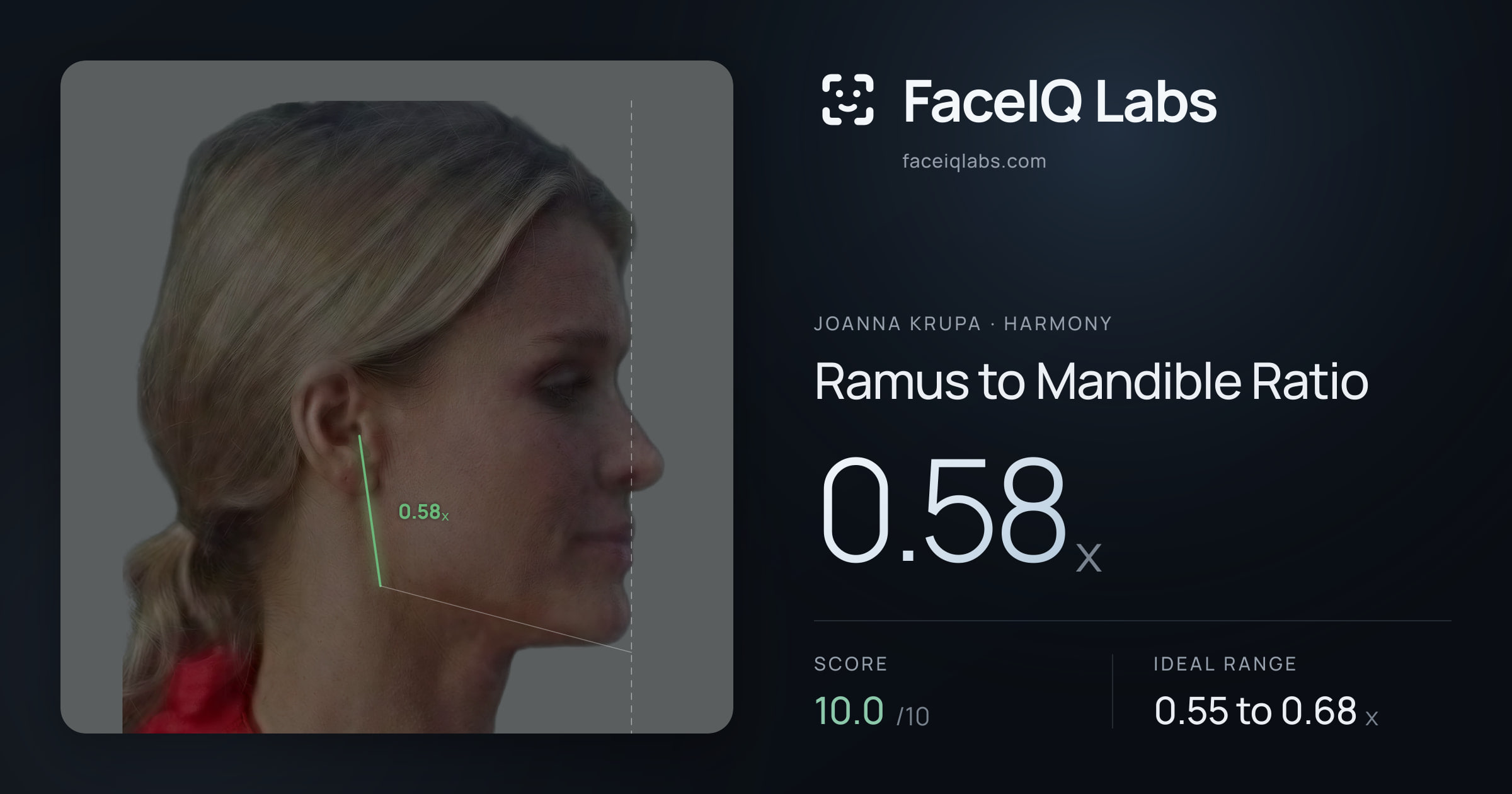 Joanna Krupa Ramus to Mandible Ratio: 0.58x, drawn on the photo