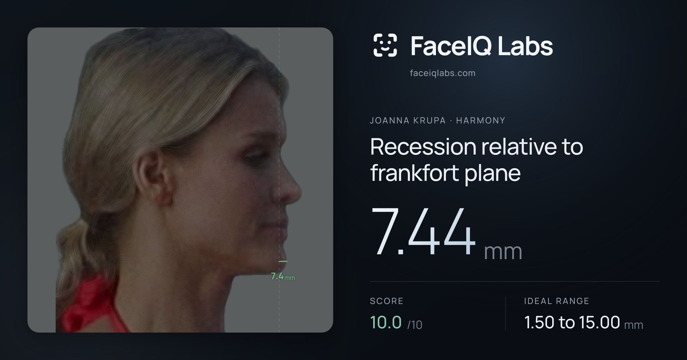 Joanna Krupa Recession relative to frankfort plane: 7.44mm, drawn on the photo