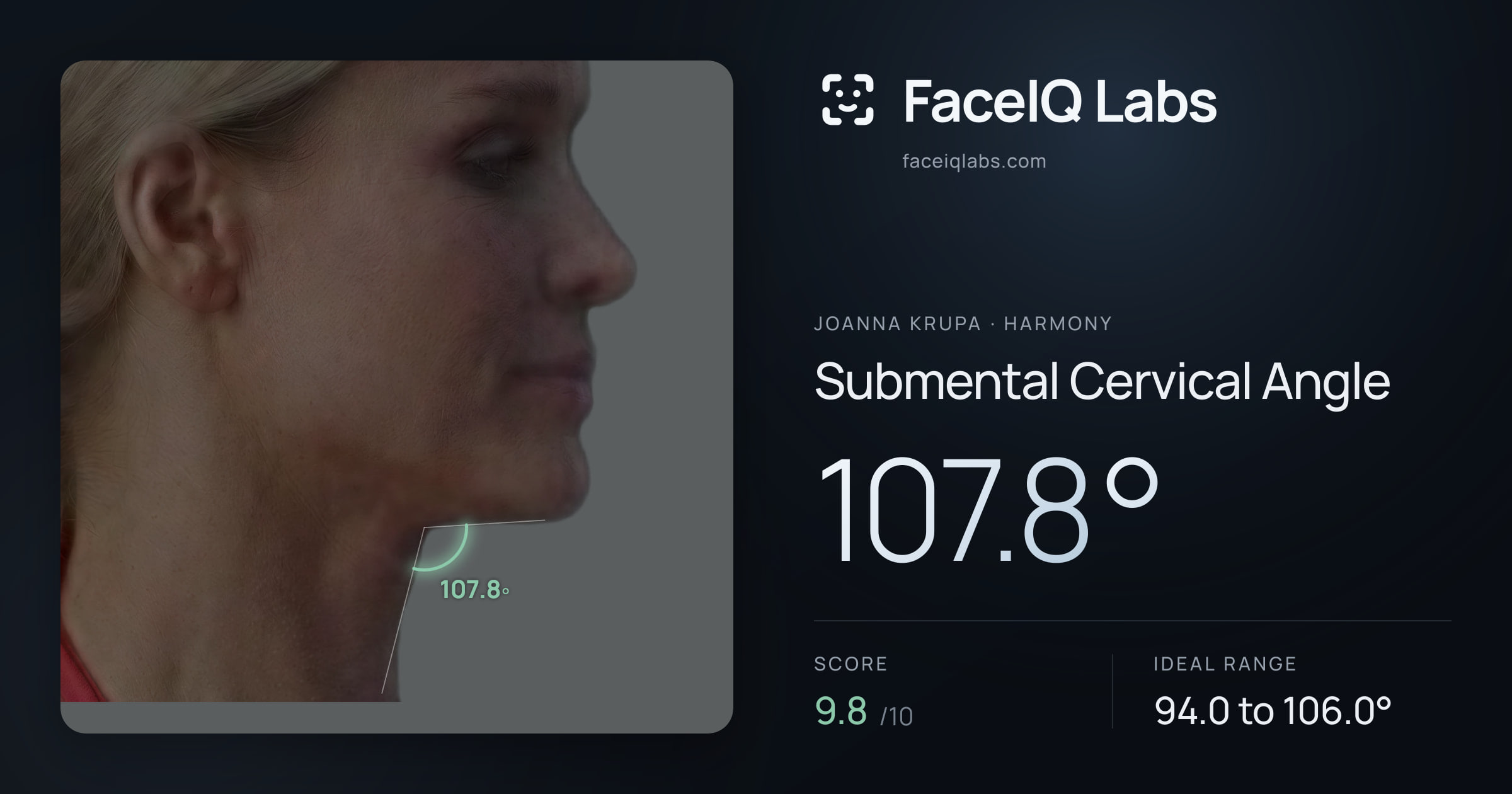 Joanna Krupa Submental Cervical Angle: 107.8°, drawn on the photo