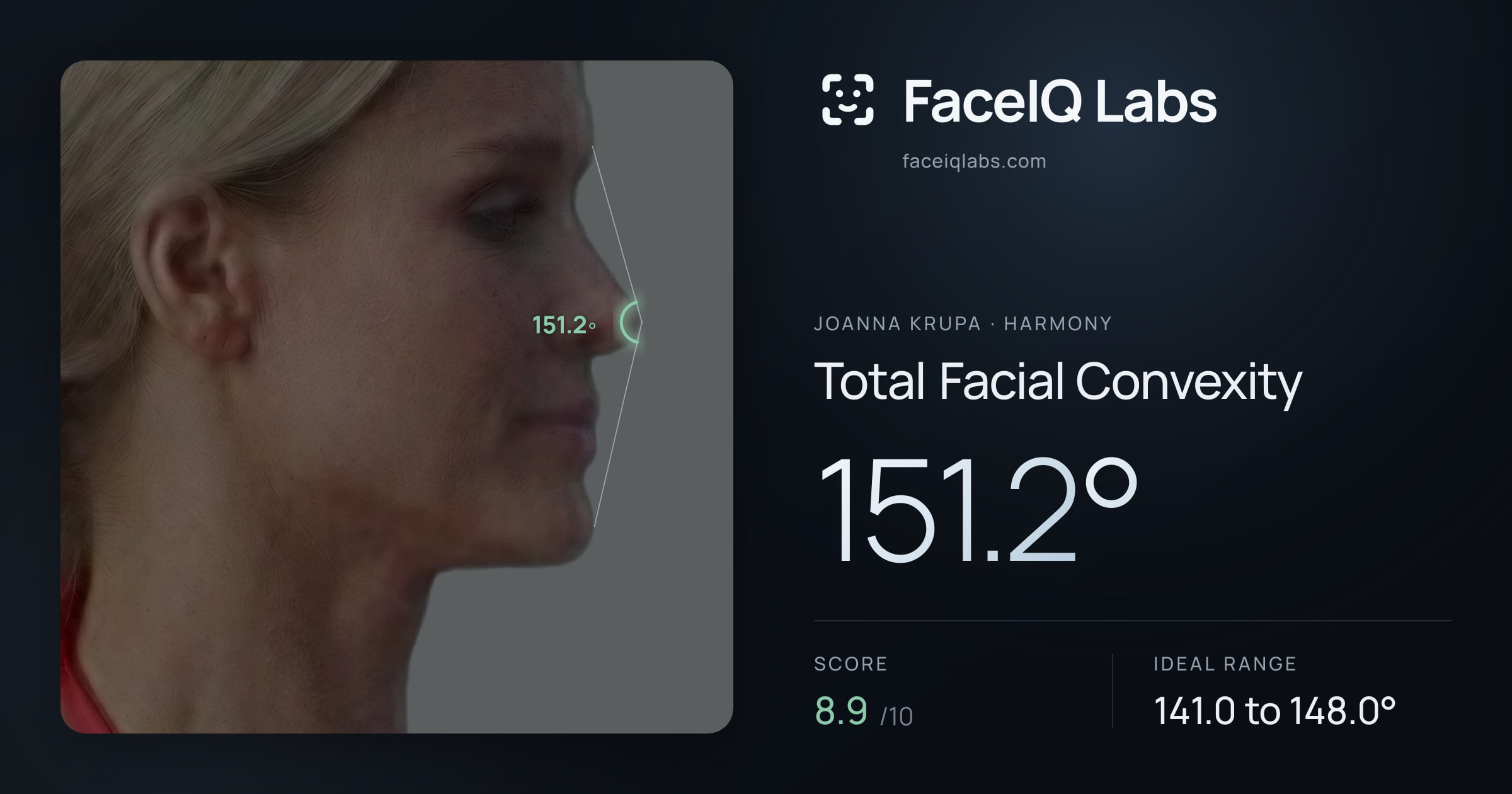 Joanna Krupa Total Facial Convexity: 151.2°, drawn on the photo
