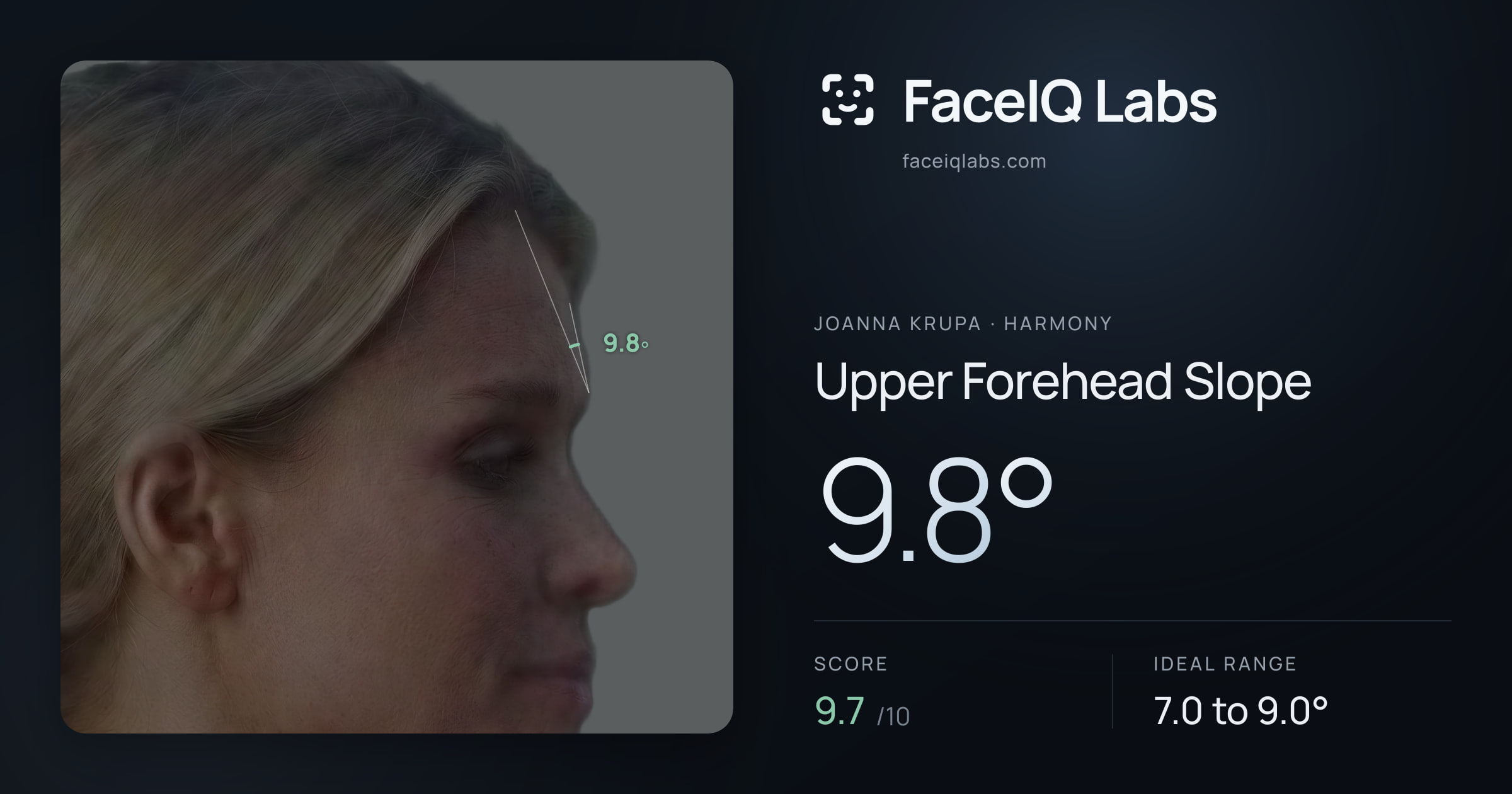 Joanna Krupa Upper Forehead Slope: 9.8°, drawn on the photo