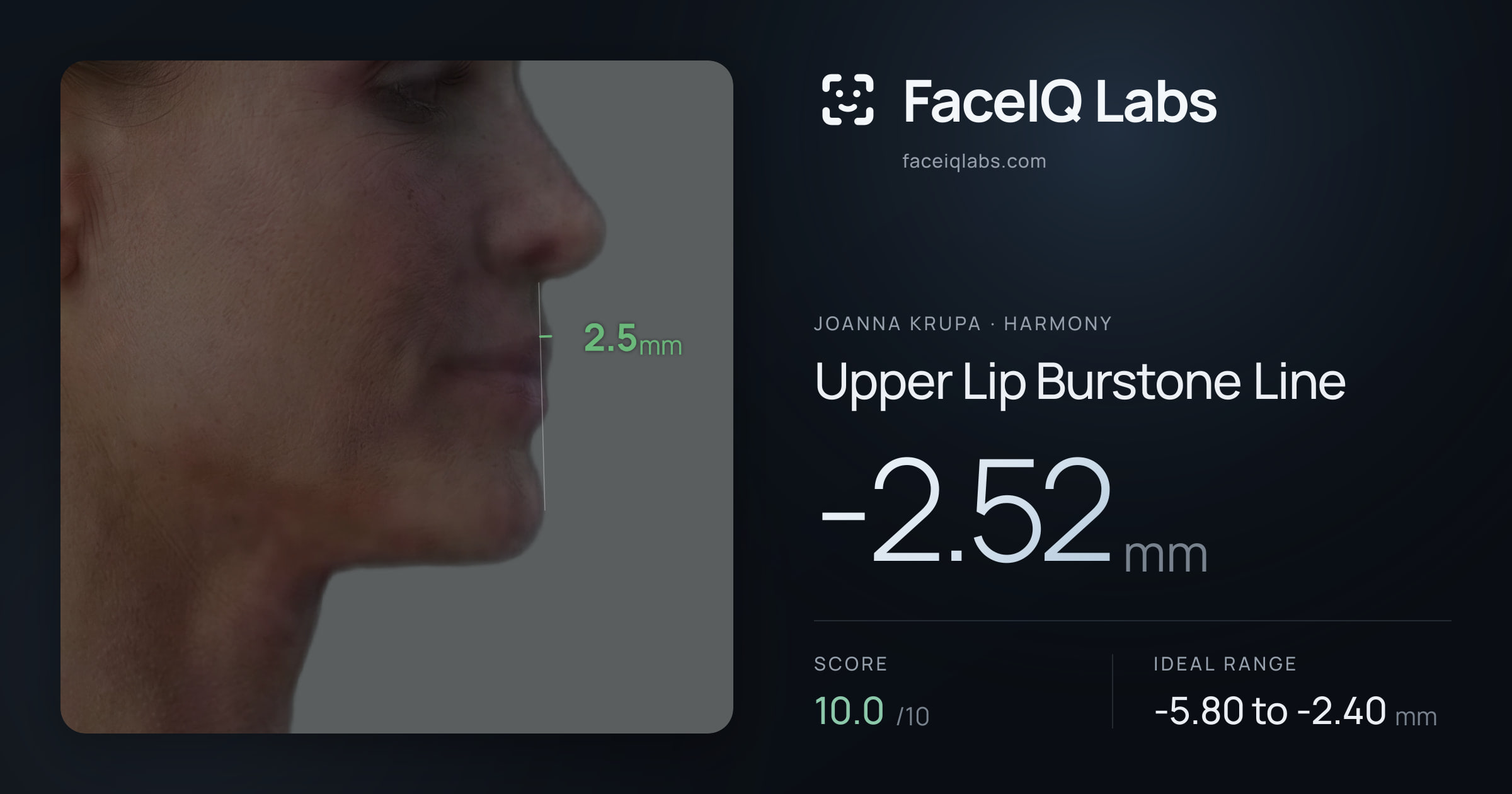 Joanna Krupa Upper Lip Burstone Line: -2.52mm, drawn on the photo
