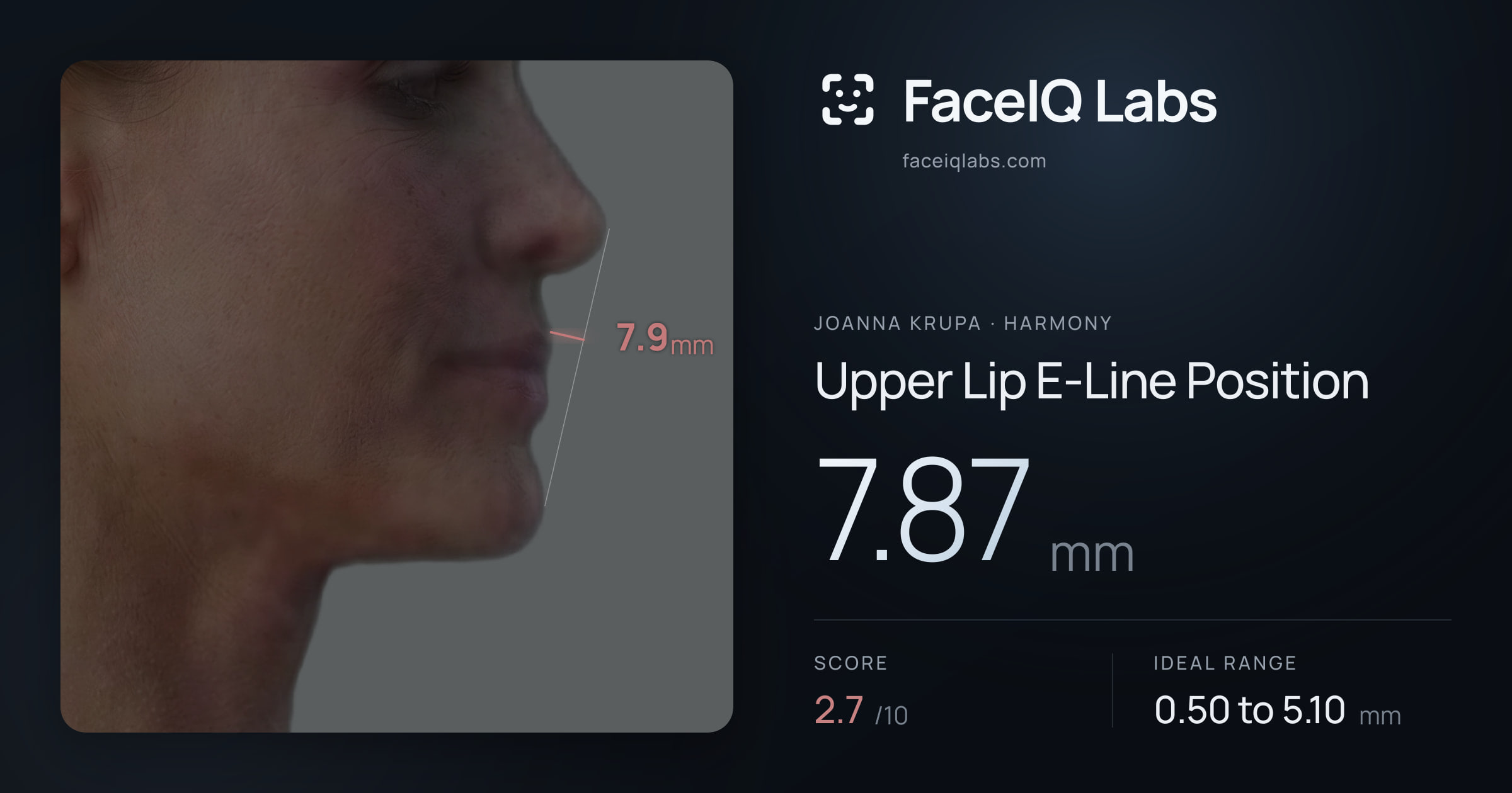 Joanna Krupa Upper Lip E-Line Position: 7.87mm, drawn on the photo
