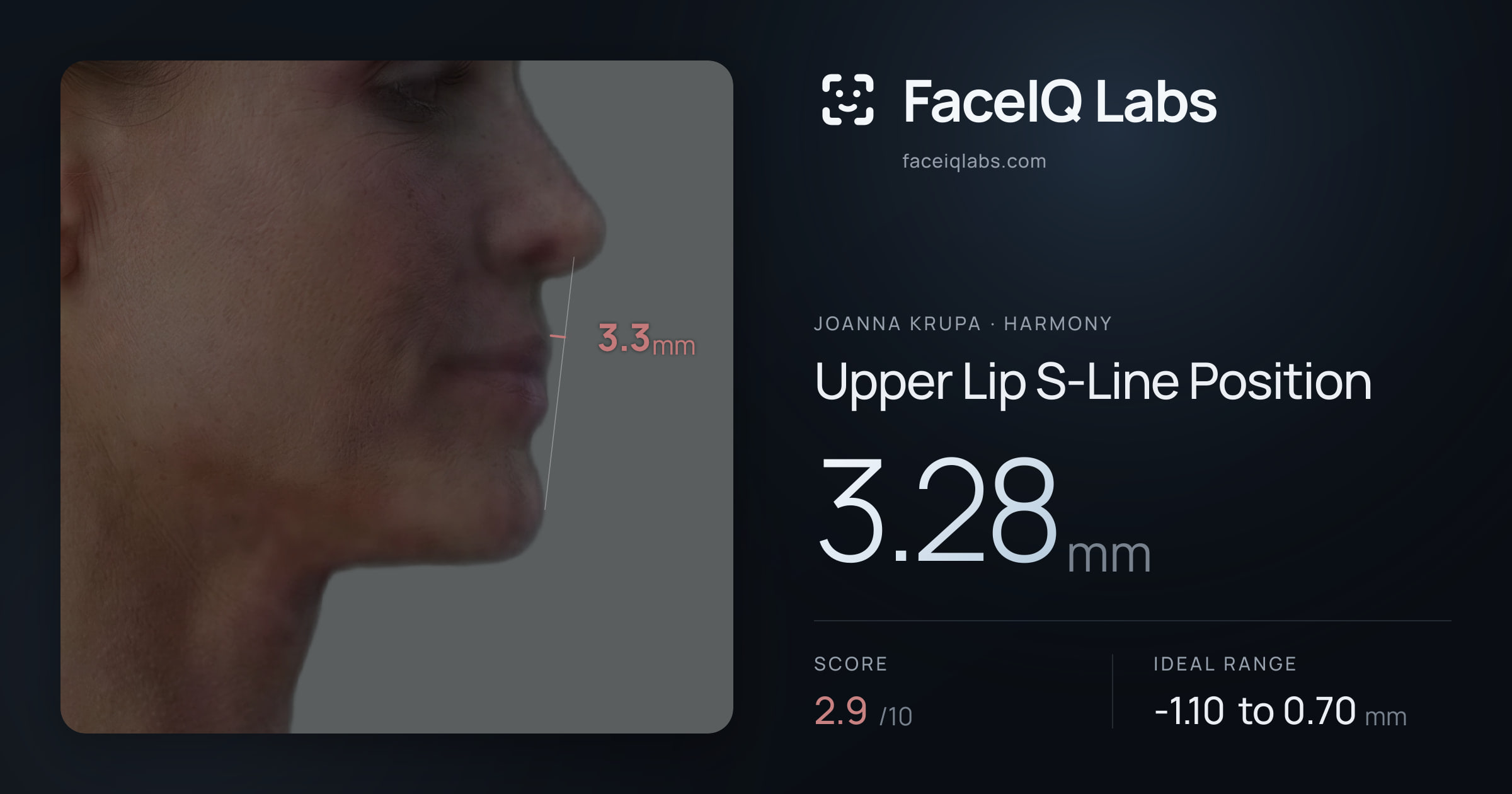 Joanna Krupa Upper Lip S-Line Position: 3.28mm, drawn on the photo