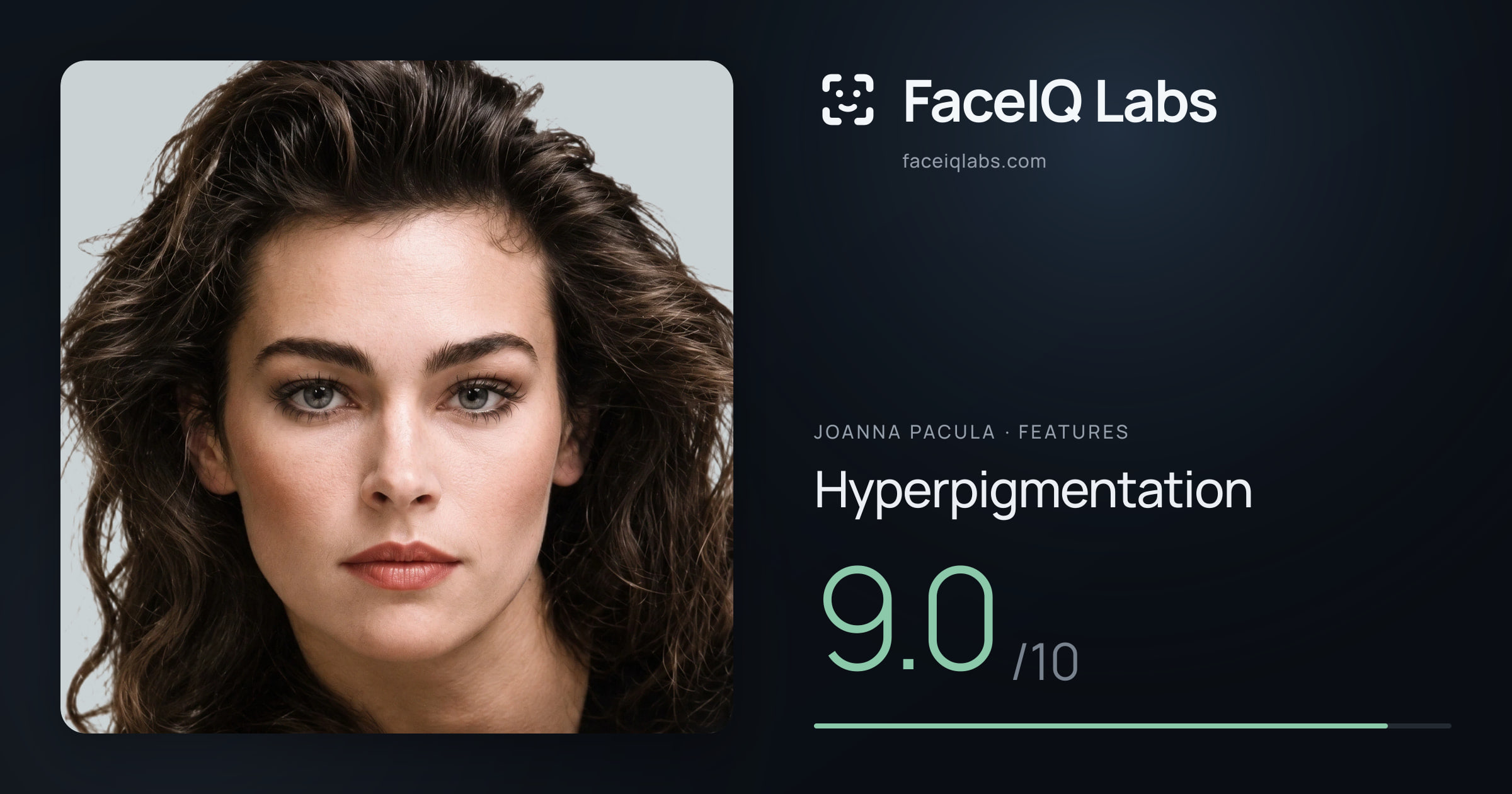 Joanna Pacula Hyperpigmentation: 9.0/10, drawn on the photo