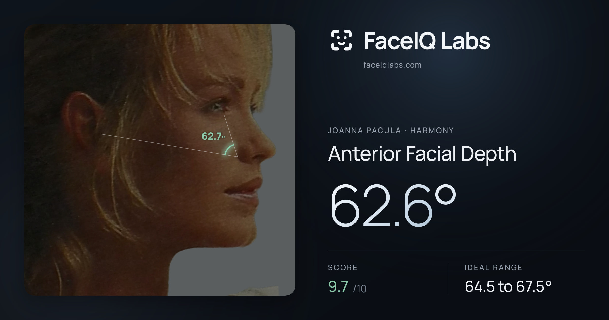 Joanna Pacula Anterior Facial Depth: 62.6°, drawn on the photo