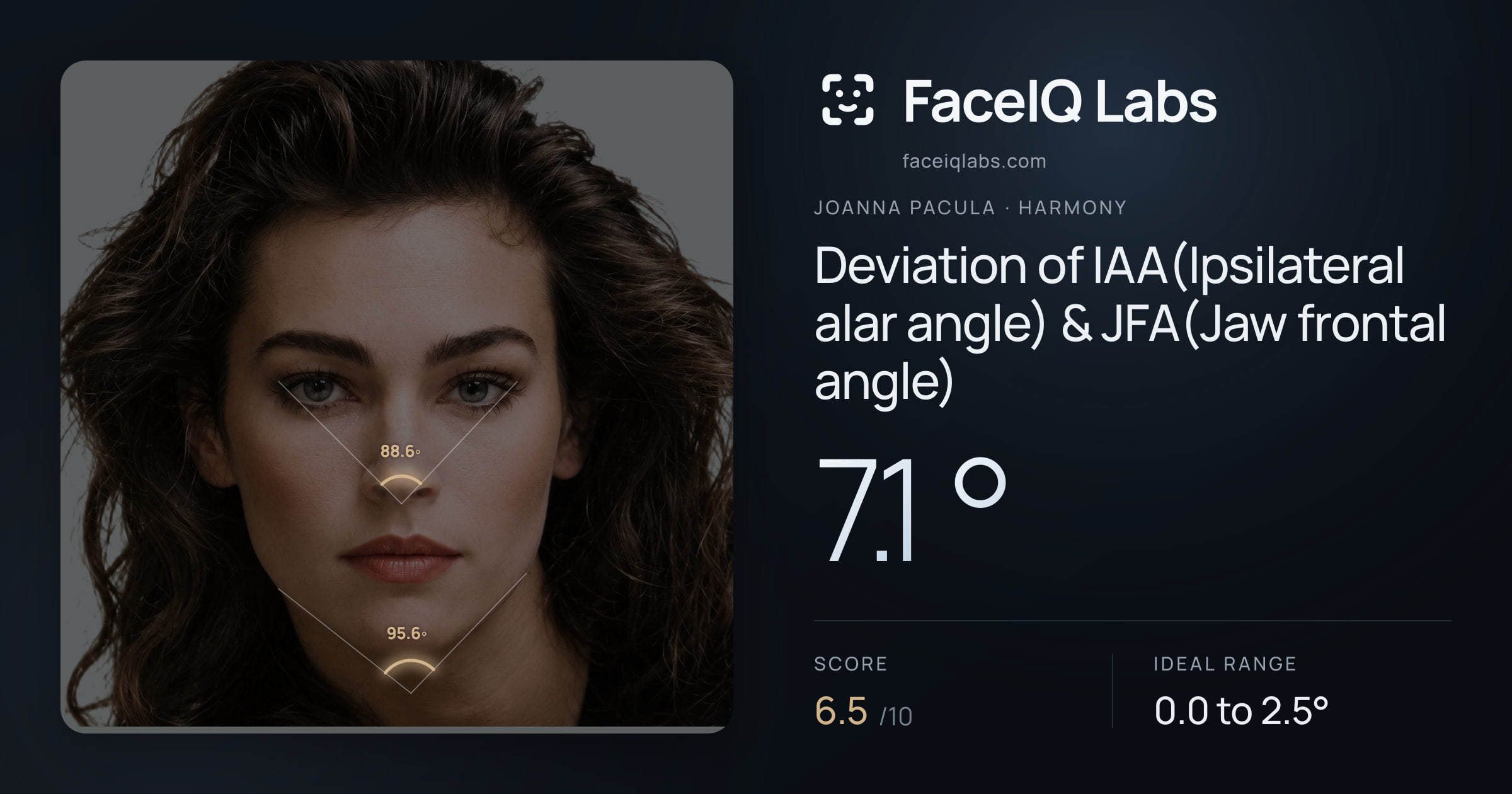 Joanna Pacula Deviation of IAA(Ipsilateral alar angle) & JFA(Jaw frontal angle): 7.1°, drawn on the photo