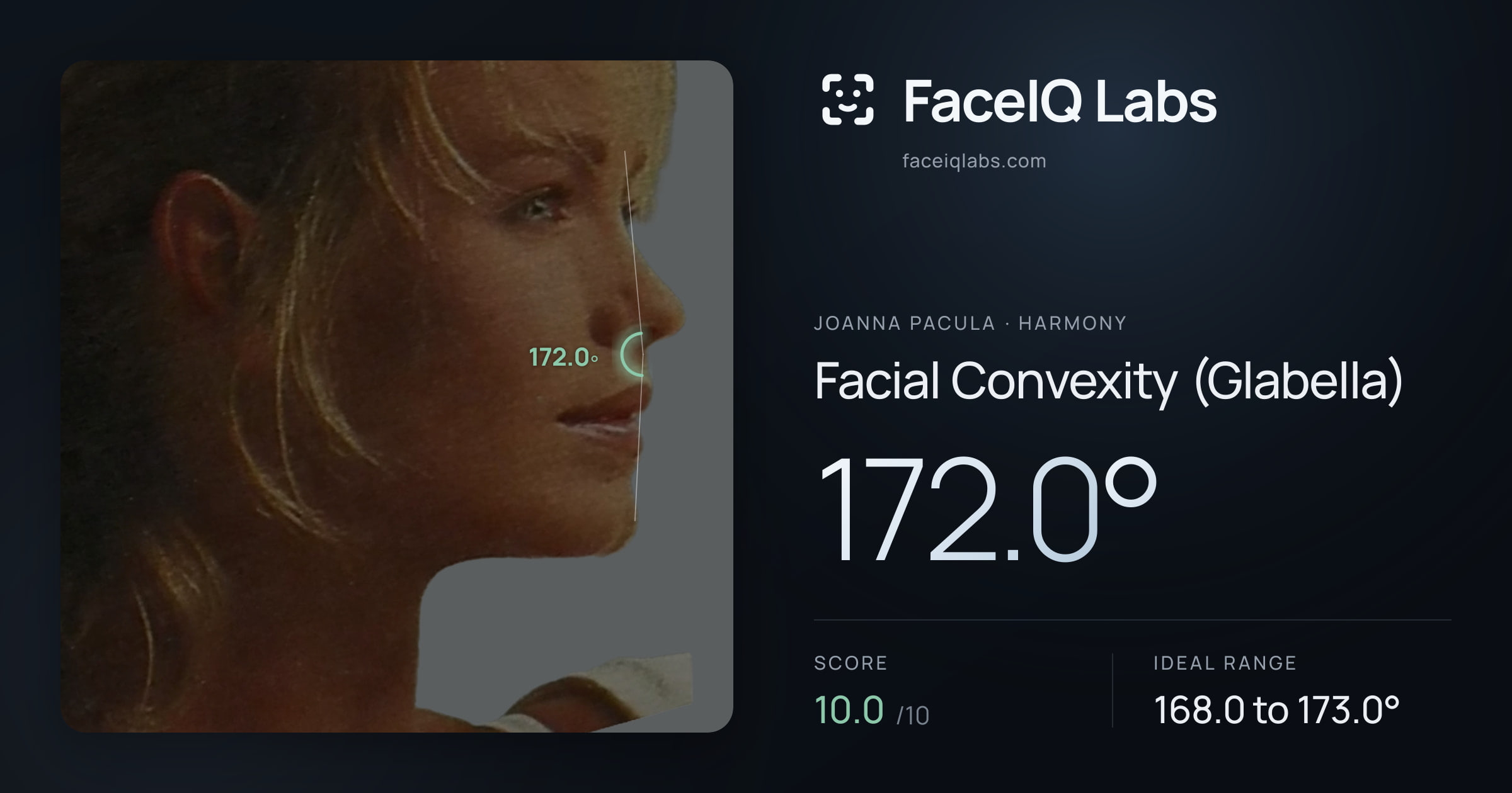 Joanna Pacula Facial Convexity (Glabella): 172.0°, drawn on the photo