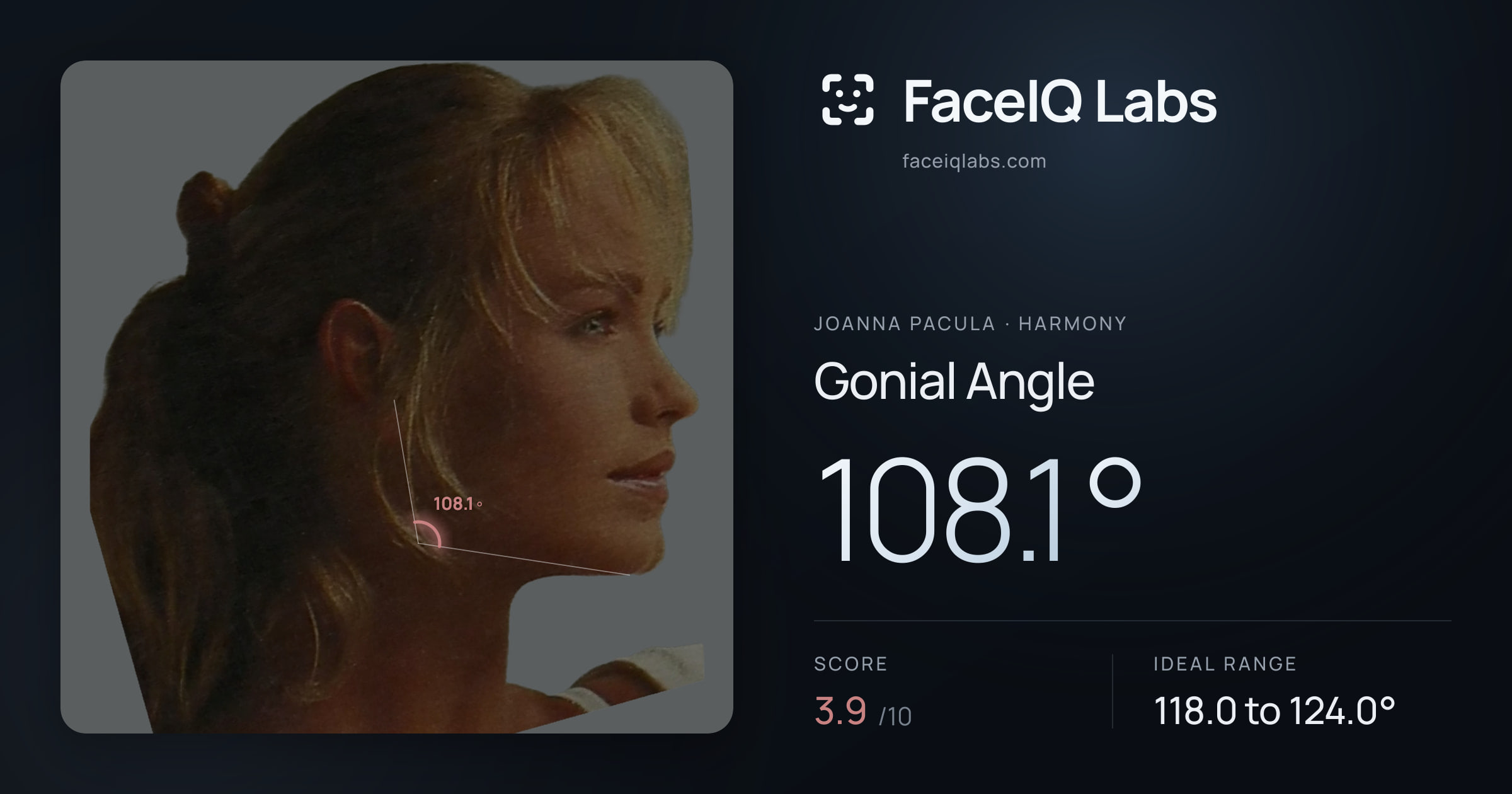 Joanna Pacula Gonial Angle: 108.1°, drawn on the photo