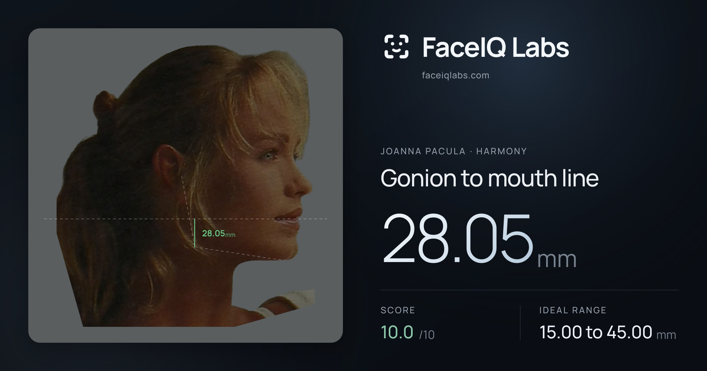 Joanna Pacula Gonion to mouth line: 28.05mm, drawn on the photo