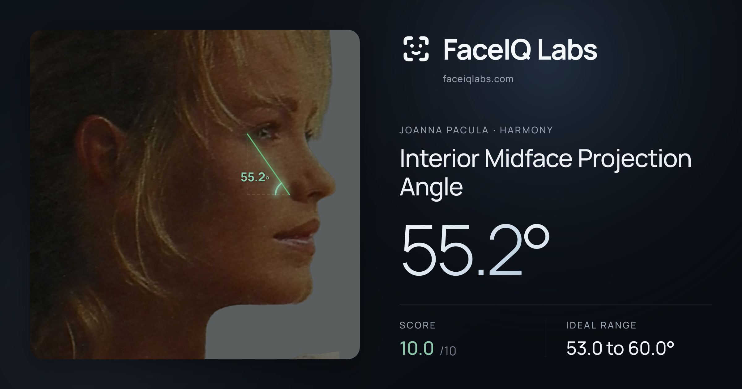Joanna Pacula Interior Midface Projection Angle: 55.2°, drawn on the photo
