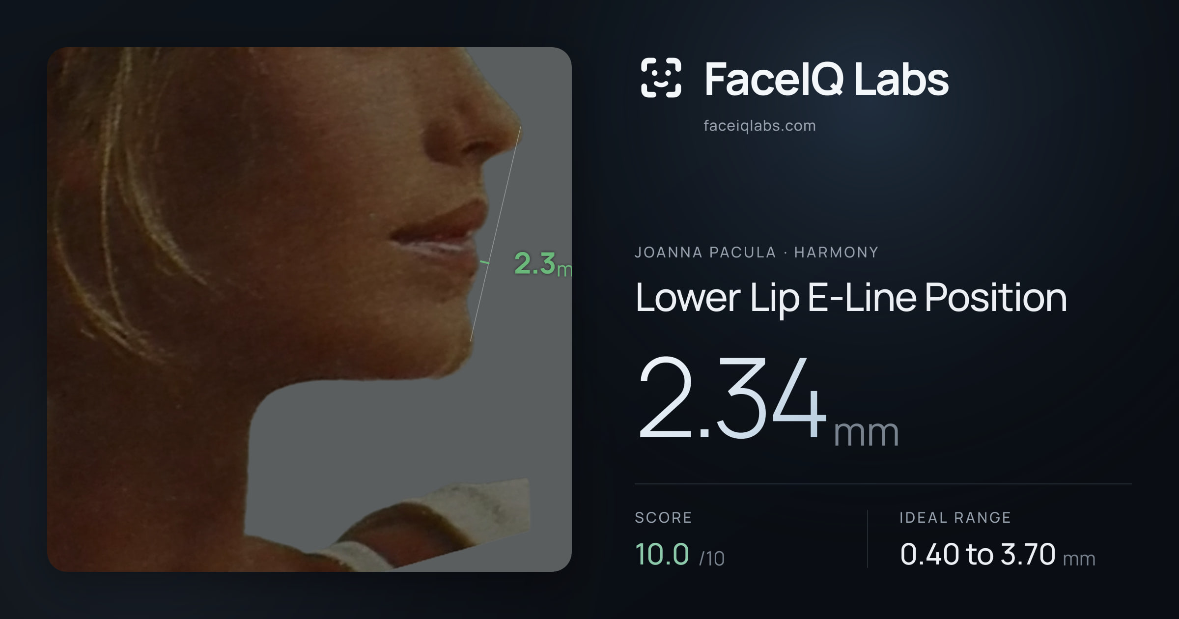 Joanna Pacula Lower Lip E-Line Position: 2.34mm, drawn on the photo