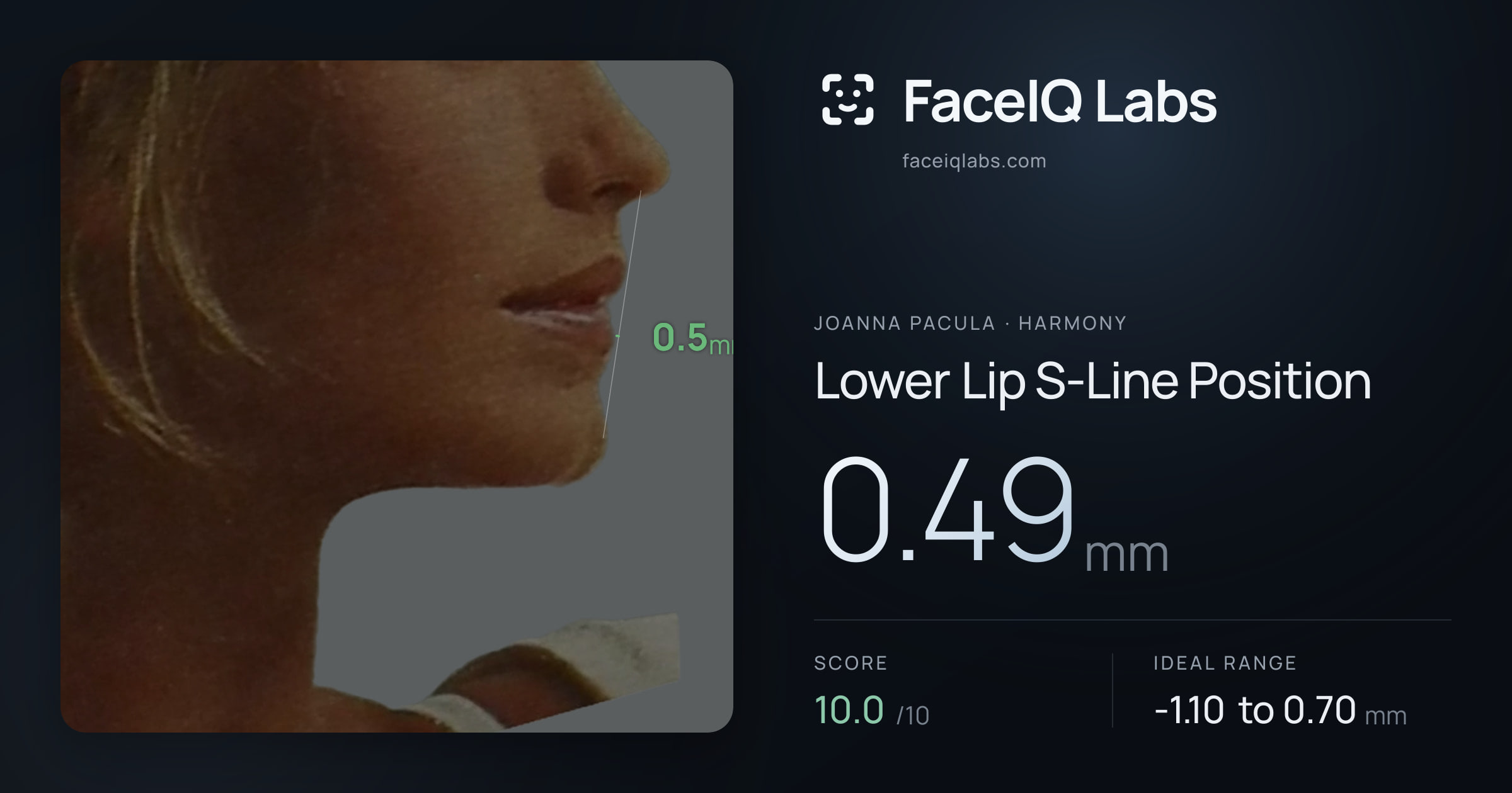 Joanna Pacula Lower Lip S-Line Position: 0.49mm, drawn on the photo