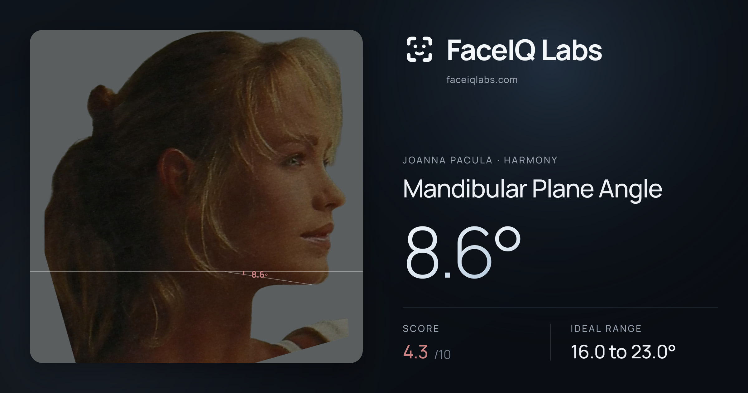 Joanna Pacula Mandibular Plane Angle: 8.6°, drawn on the photo
