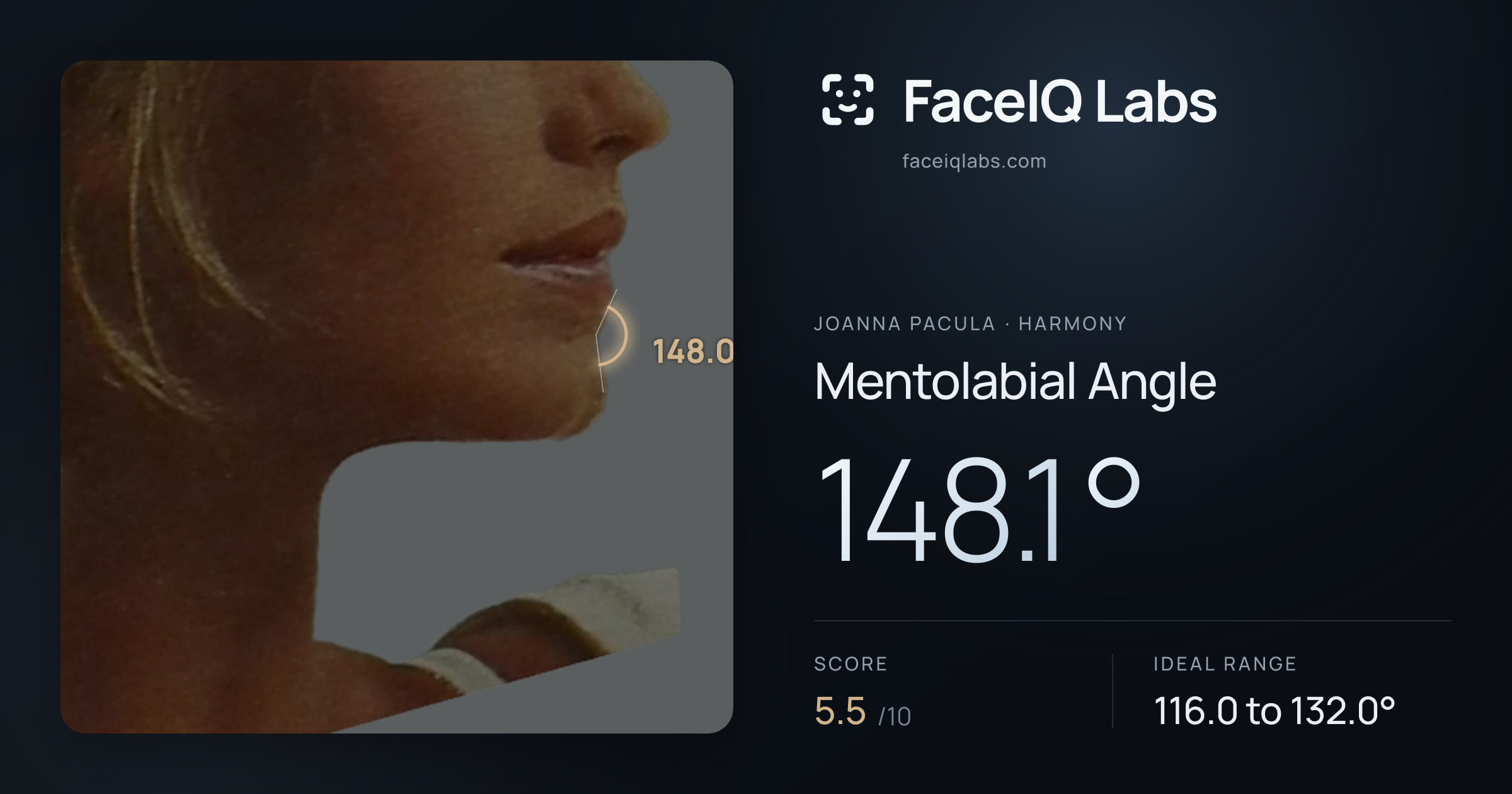 Joanna Pacula Mentolabial Angle: 148.1°, drawn on the photo