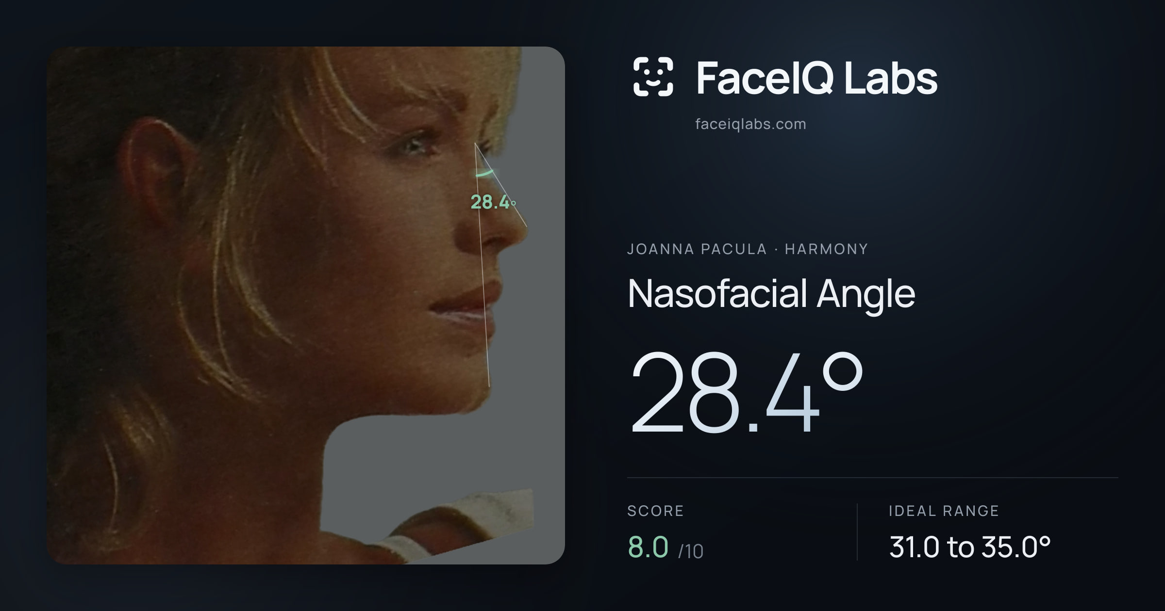 Joanna Pacula Nasofacial Angle: 28.4°, drawn on the photo