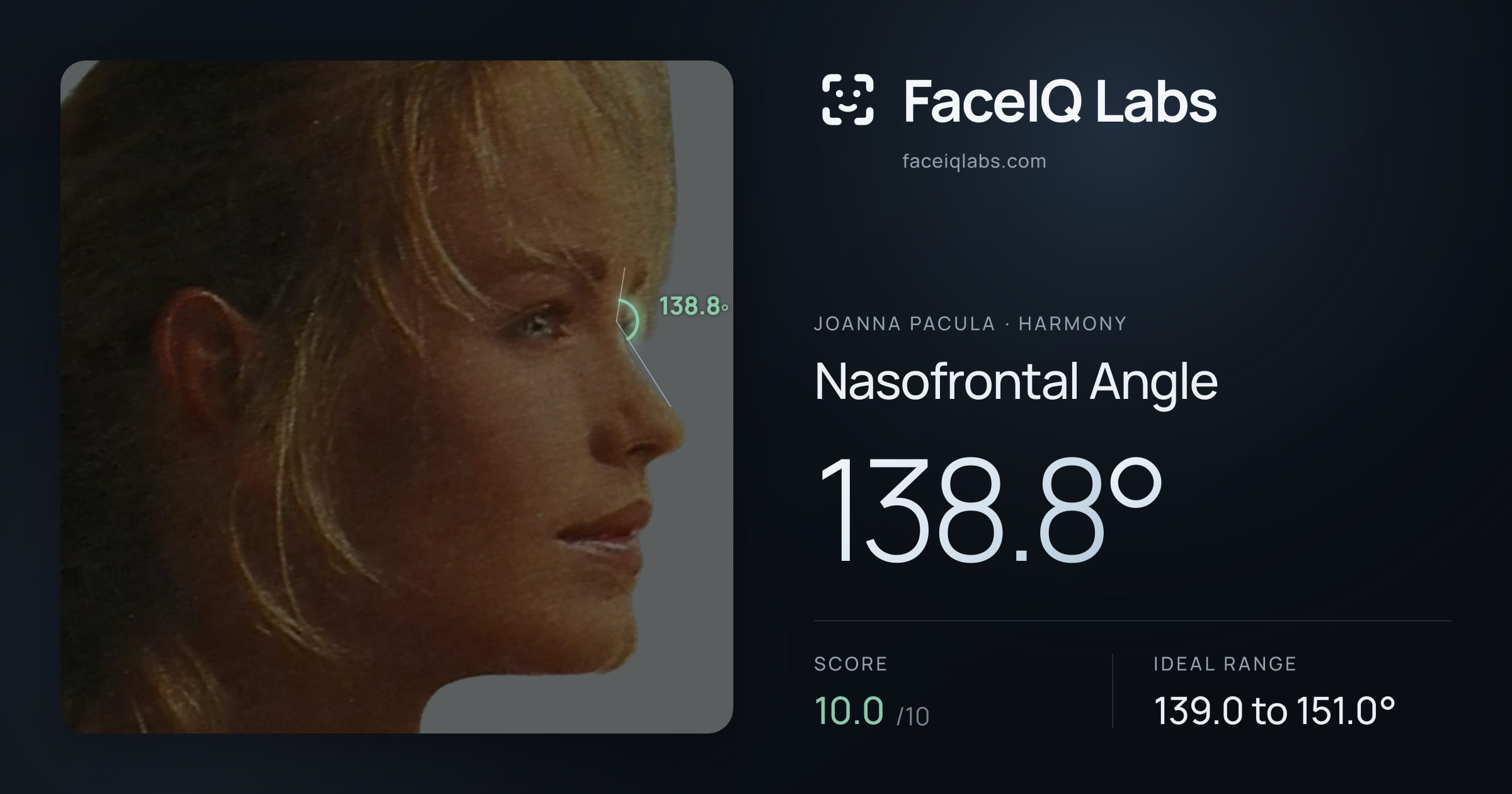 Joanna Pacula Nasofrontal Angle: 138.8°, drawn on the photo