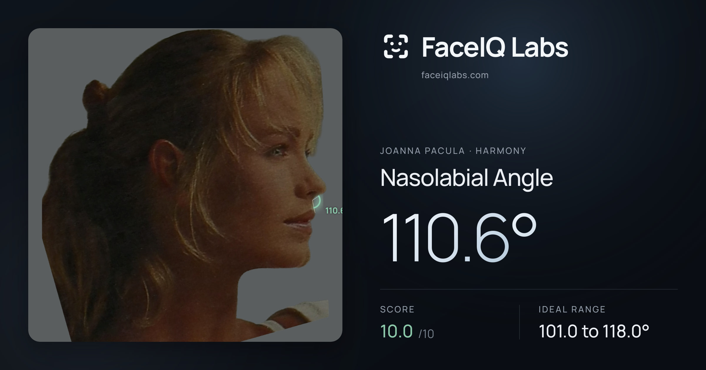 Joanna Pacula Nasolabial Angle: 110.6°, drawn on the photo