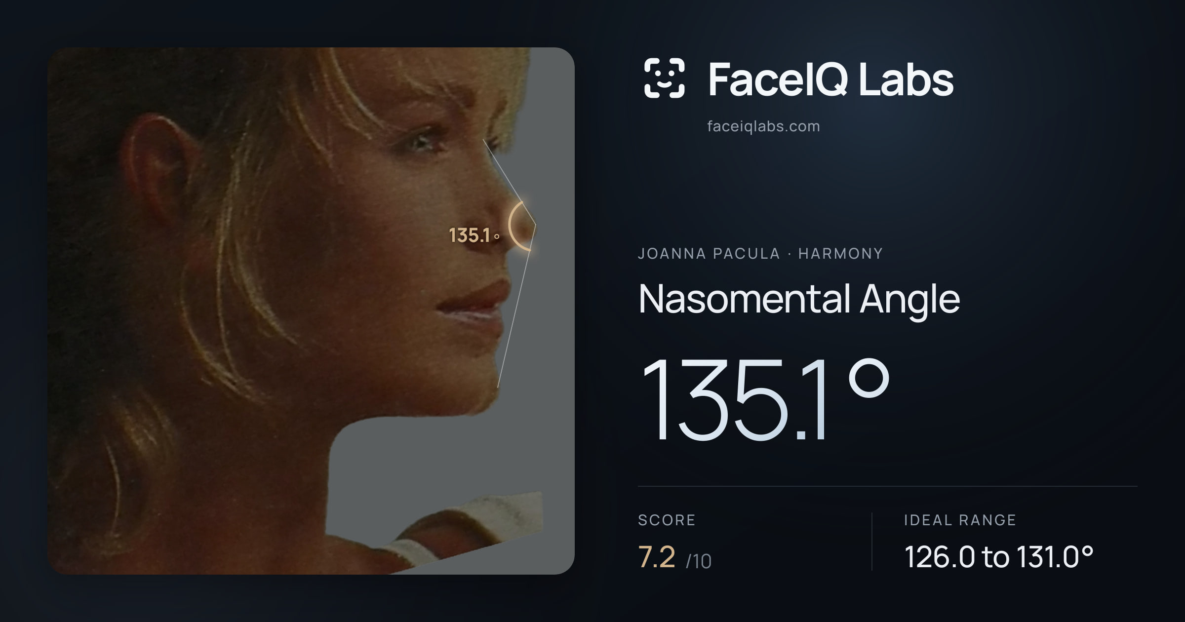 Joanna Pacula Nasomental Angle: 135.1°, drawn on the photo