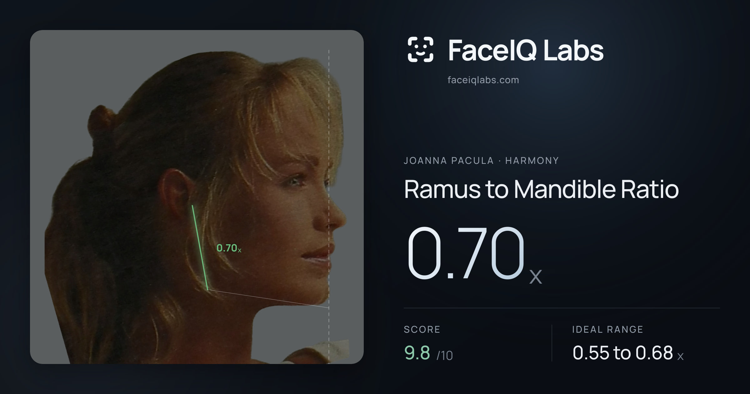 Joanna Pacula Ramus to Mandible Ratio: 0.70x, drawn on the photo
