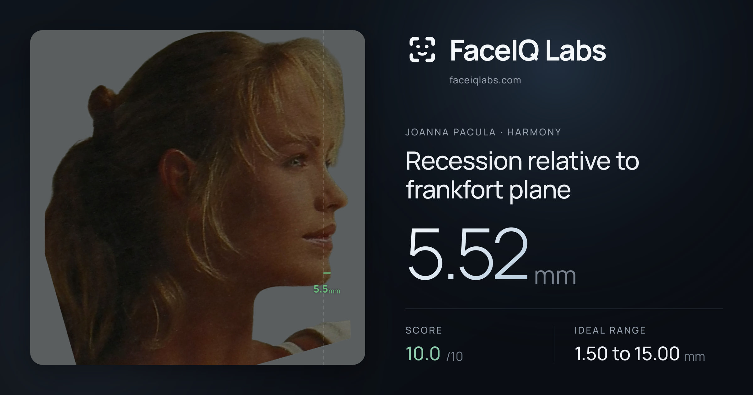 Joanna Pacula Recession relative to frankfort plane: 5.52mm, drawn on the photo
