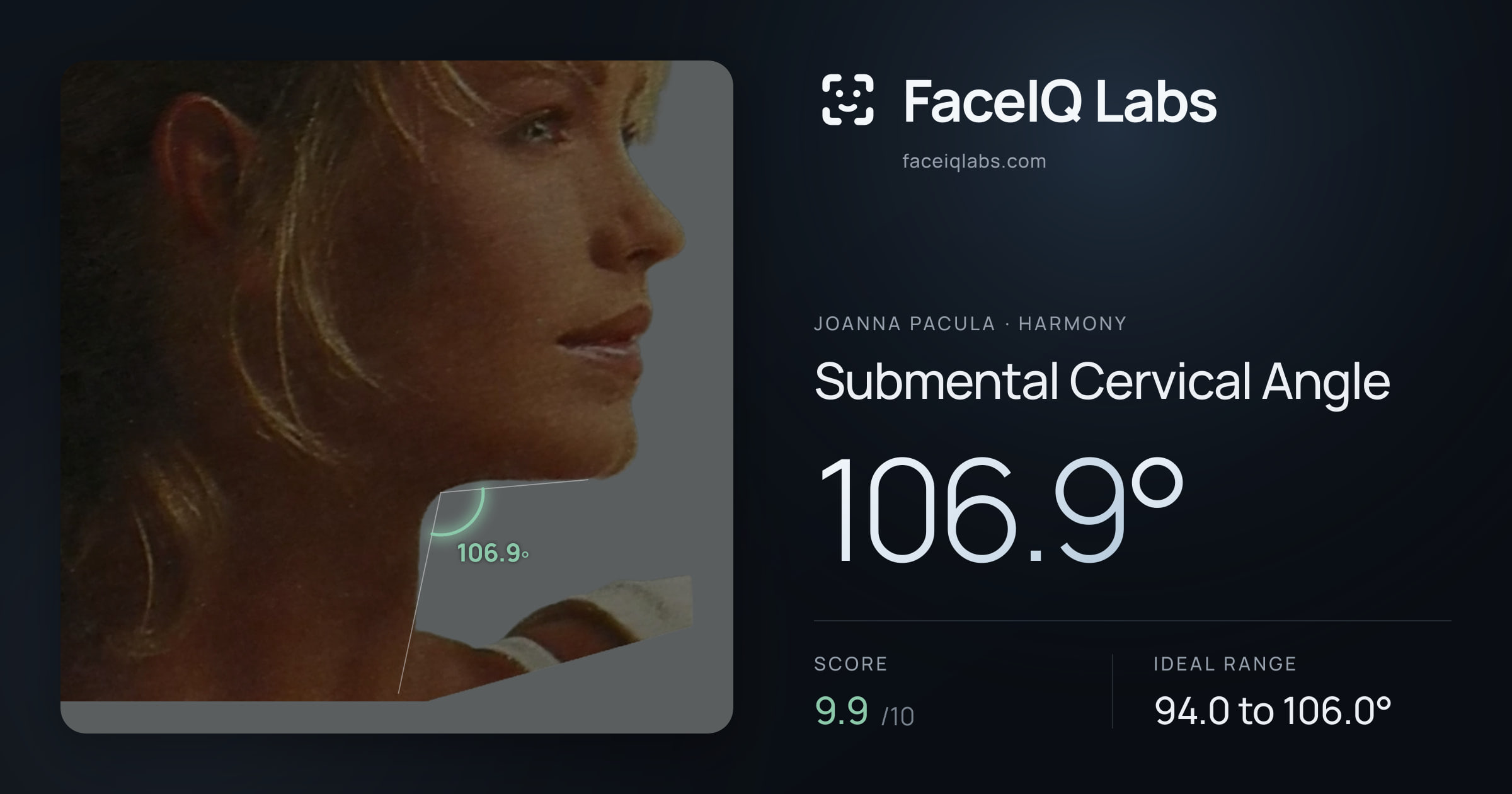 Joanna Pacula Submental Cervical Angle: 106.9°, drawn on the photo