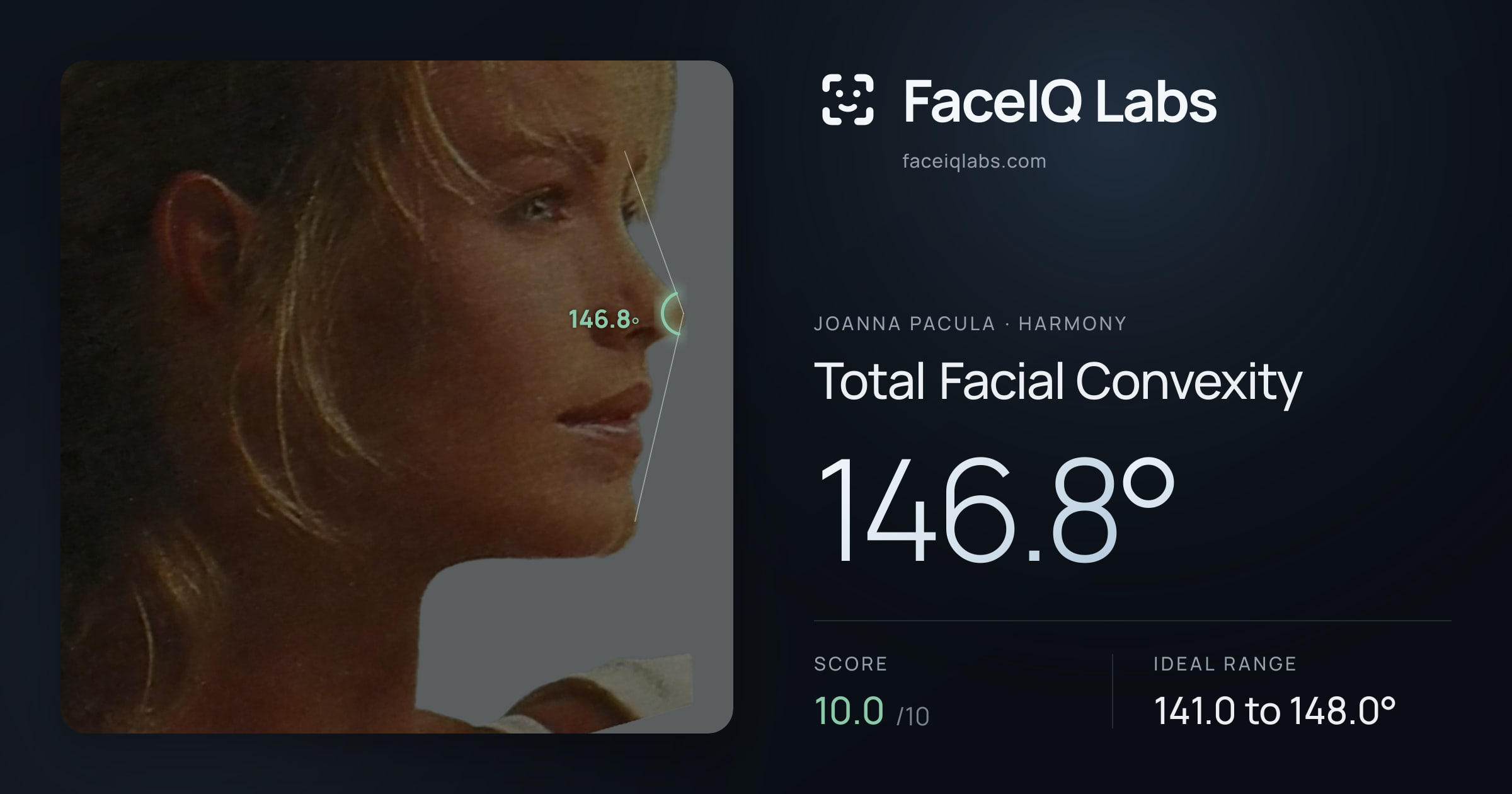 Joanna Pacula Total Facial Convexity: 146.8°, drawn on the photo