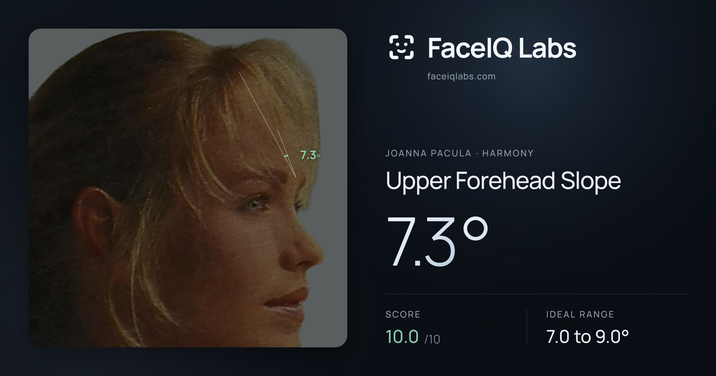 Joanna Pacula Upper Forehead Slope: 7.3°, drawn on the photo